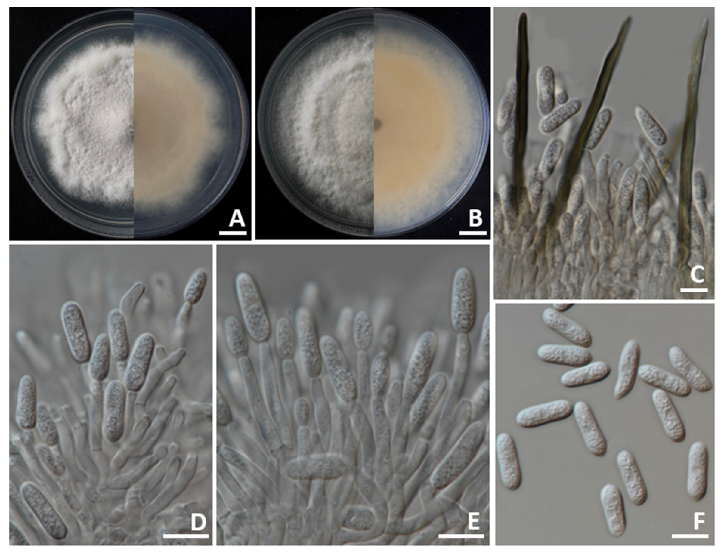 Jof 11 00540 g005 Jof 11 00540 g005