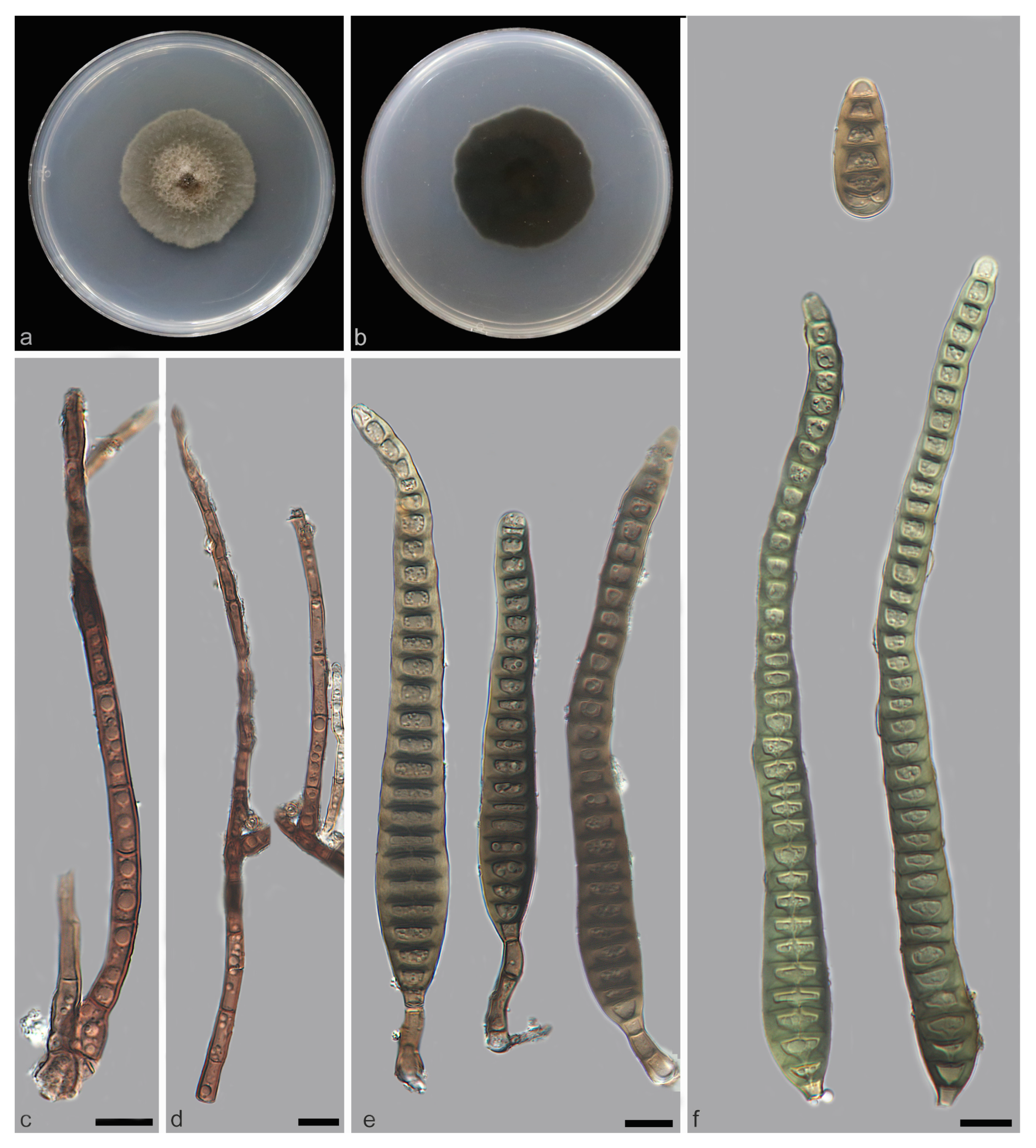 Jof 11 00667 g004 Jof 11 00667 g004