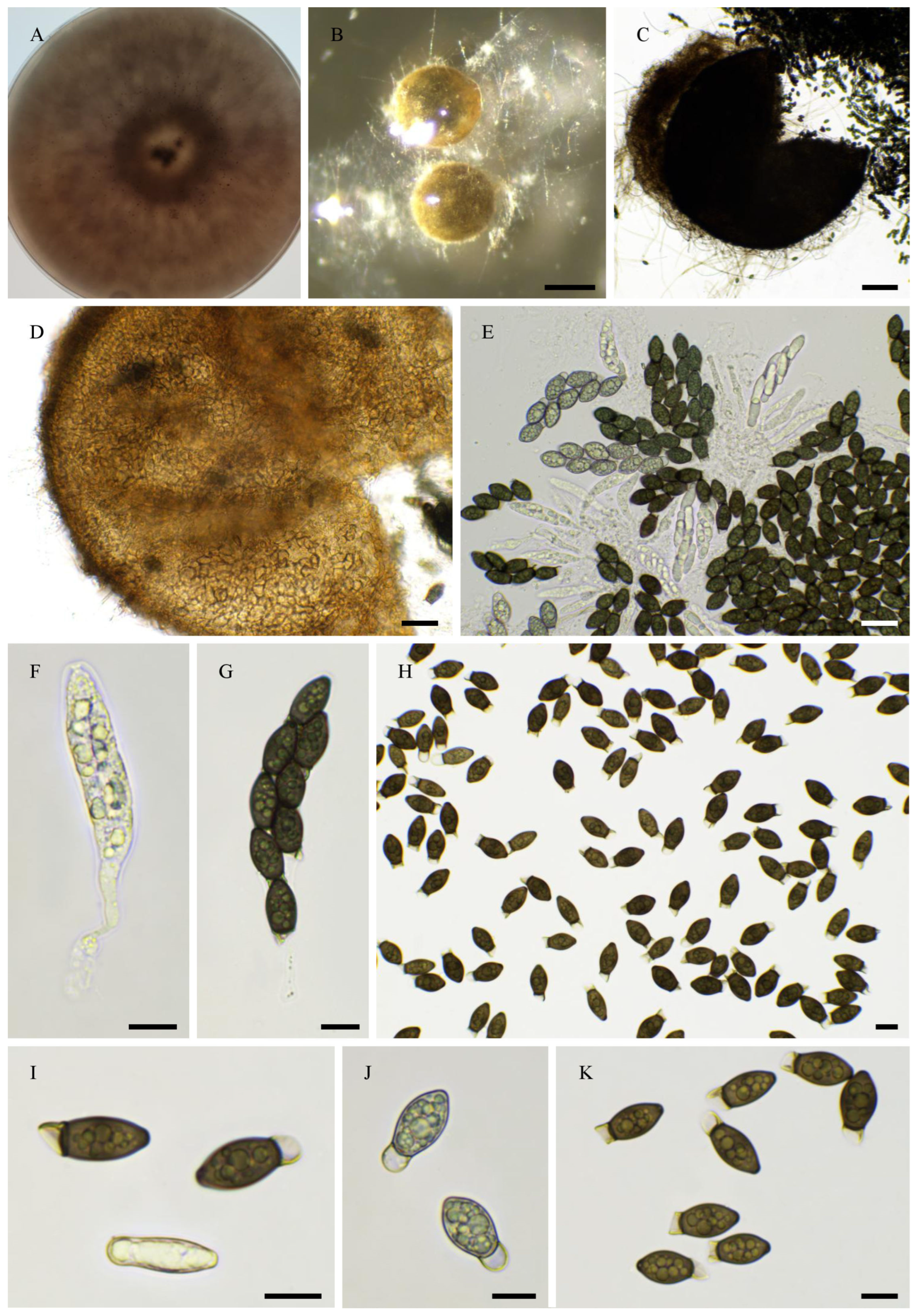 Jof 11 00880 g008 Jof 11 00880 g008