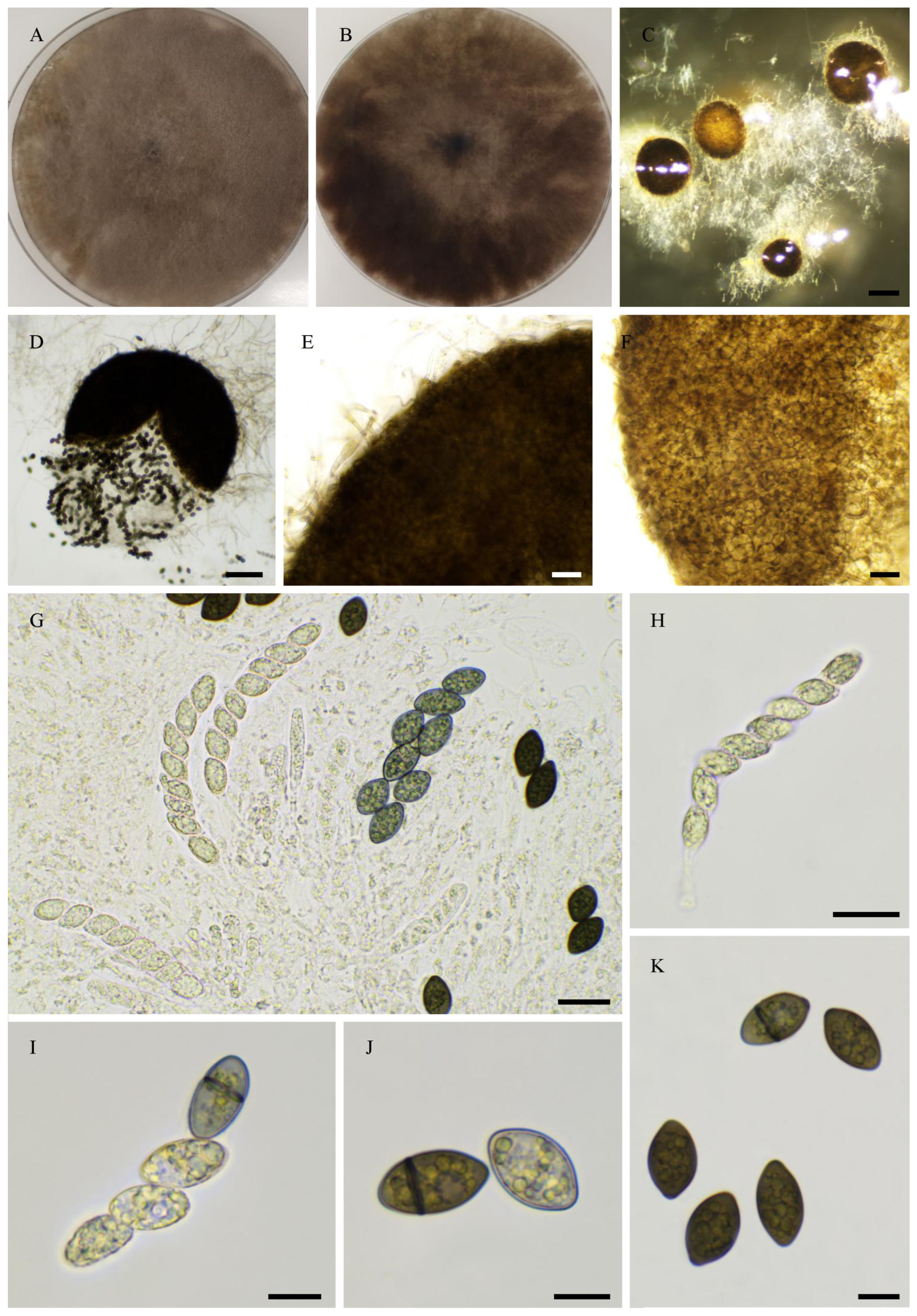 Jof 11 00880 g009 Jof 11 00880 g009