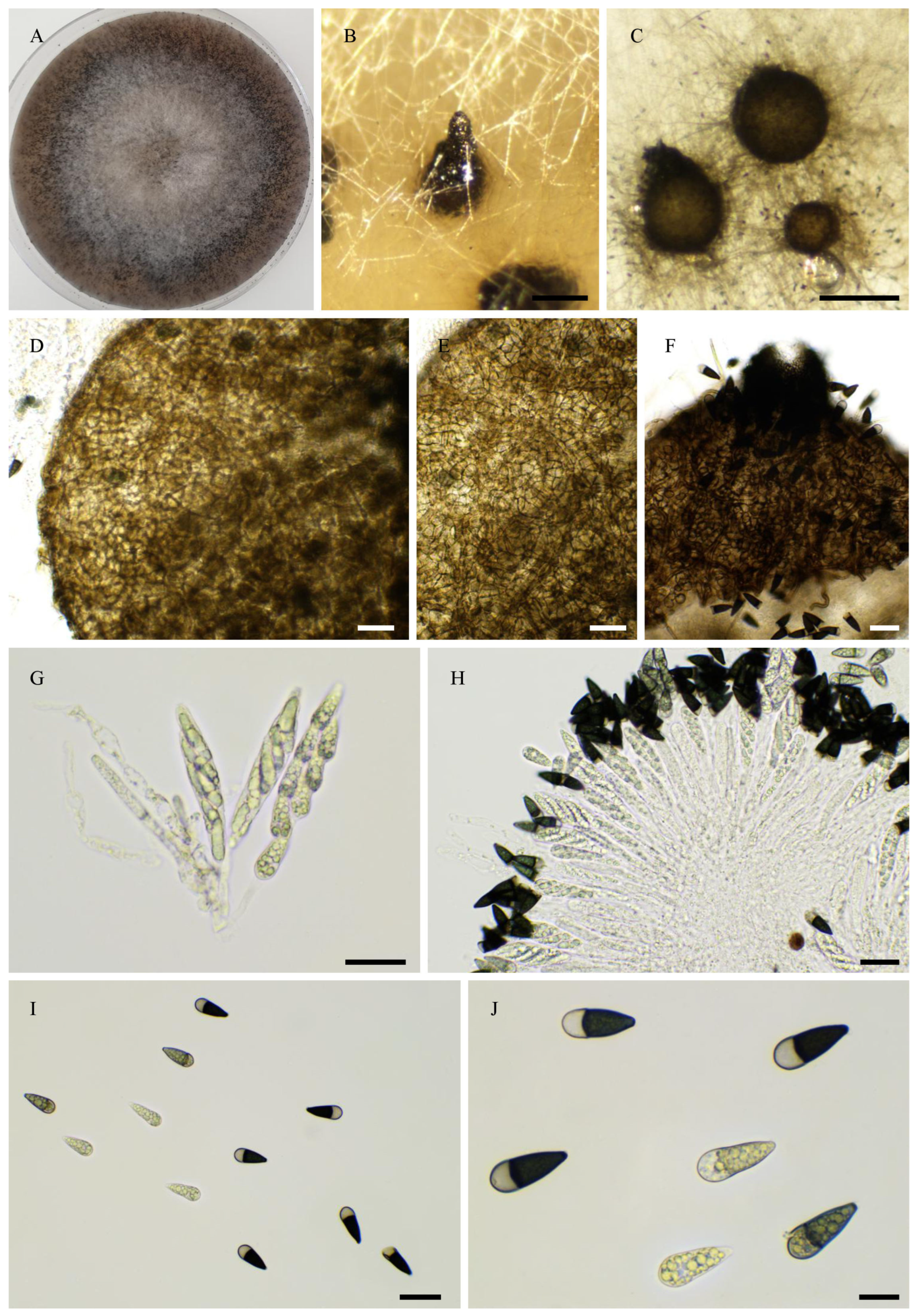 Jof 11 00880 g010 Jof 11 00880 g010