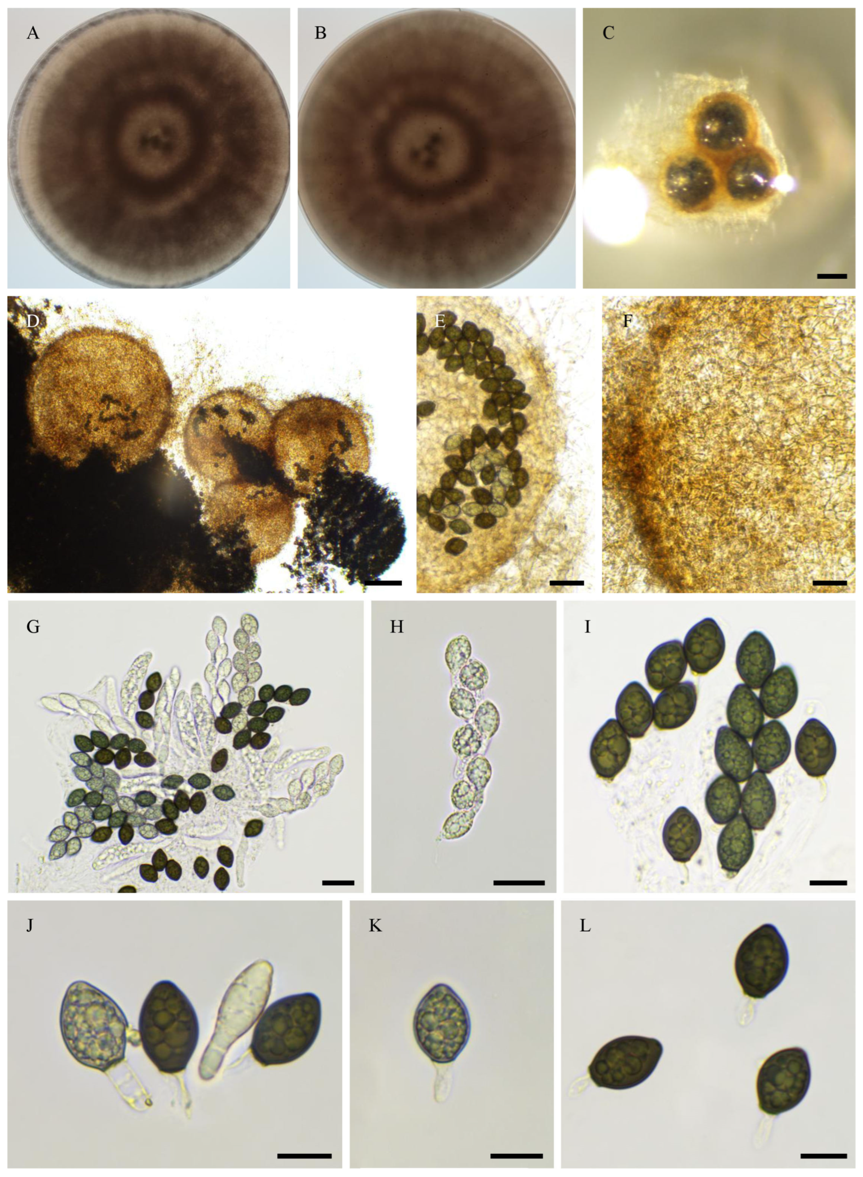 Jof 11 00880 g011 Jof 11 00880 g011