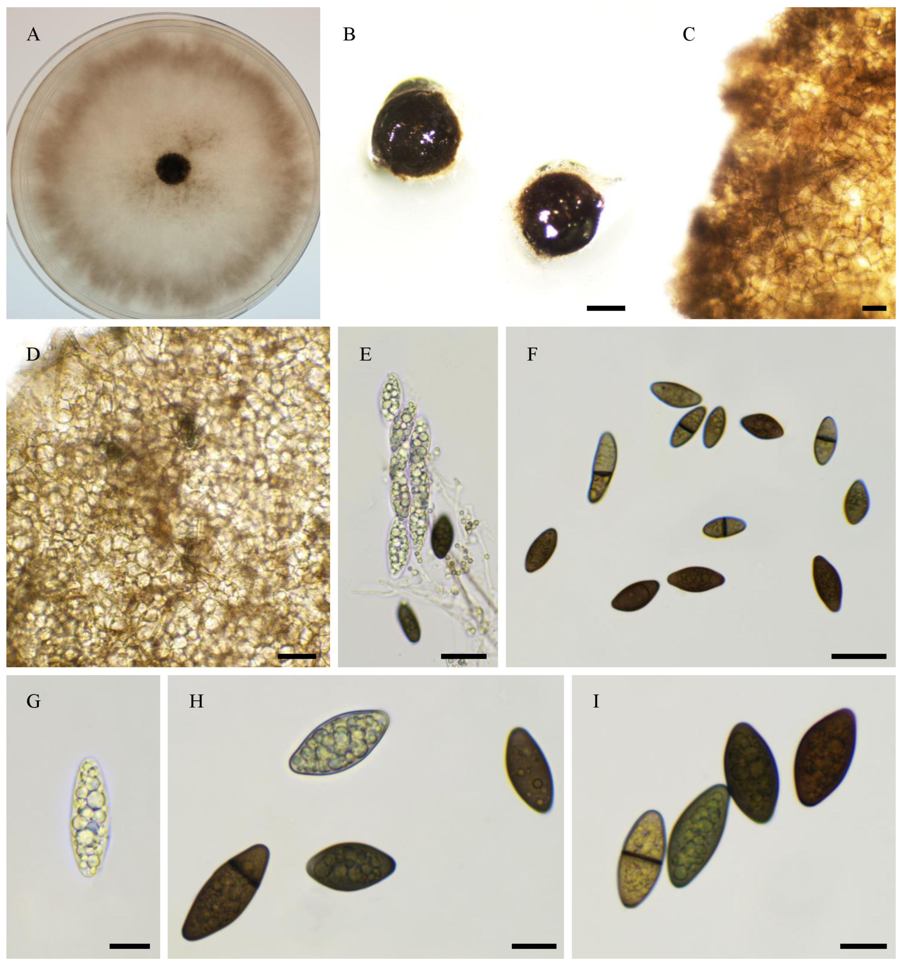 Jof 11 00880 g013 Jof 11 00880 g013