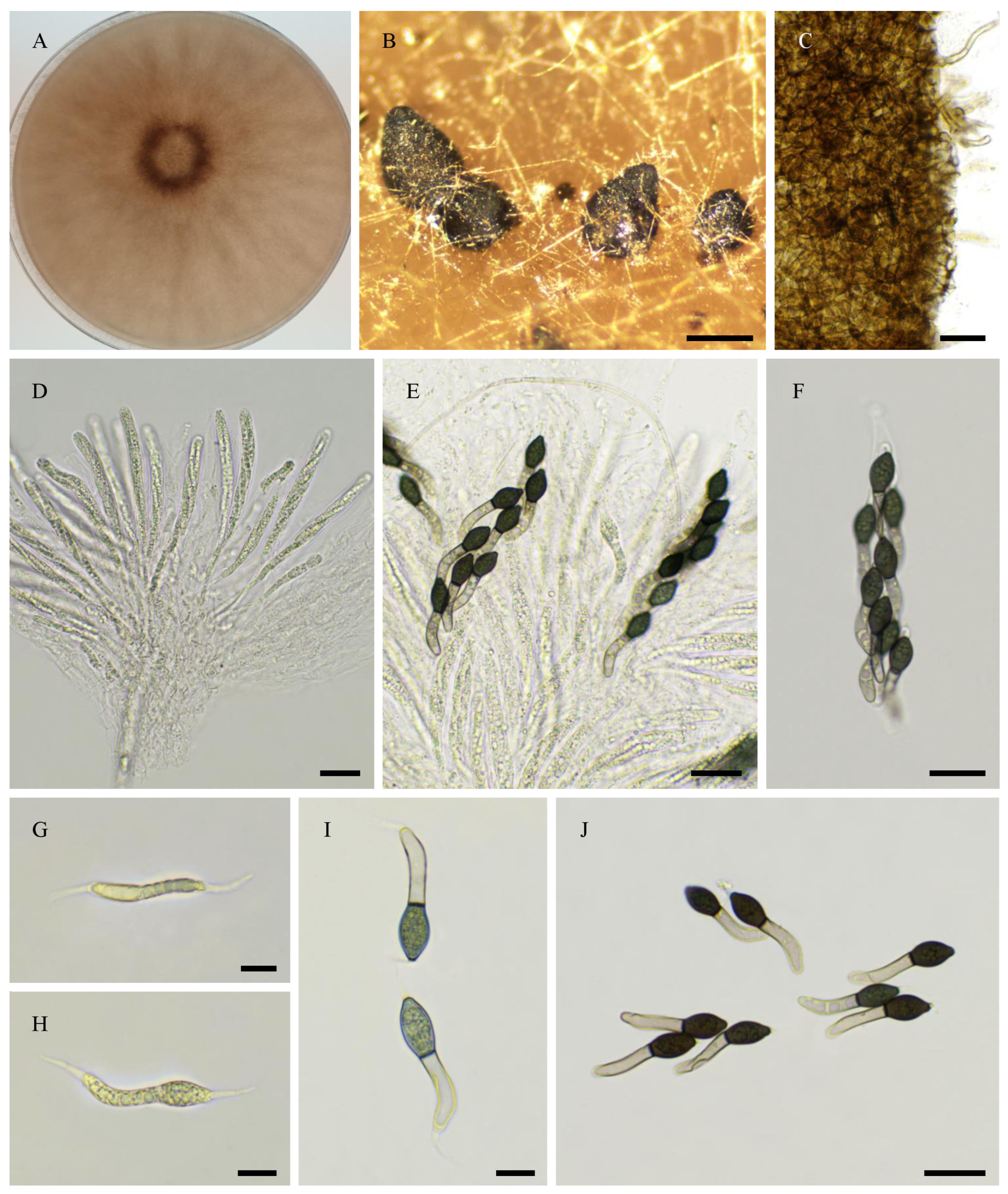 Jof 11 00880 g014 Jof 11 00880 g014