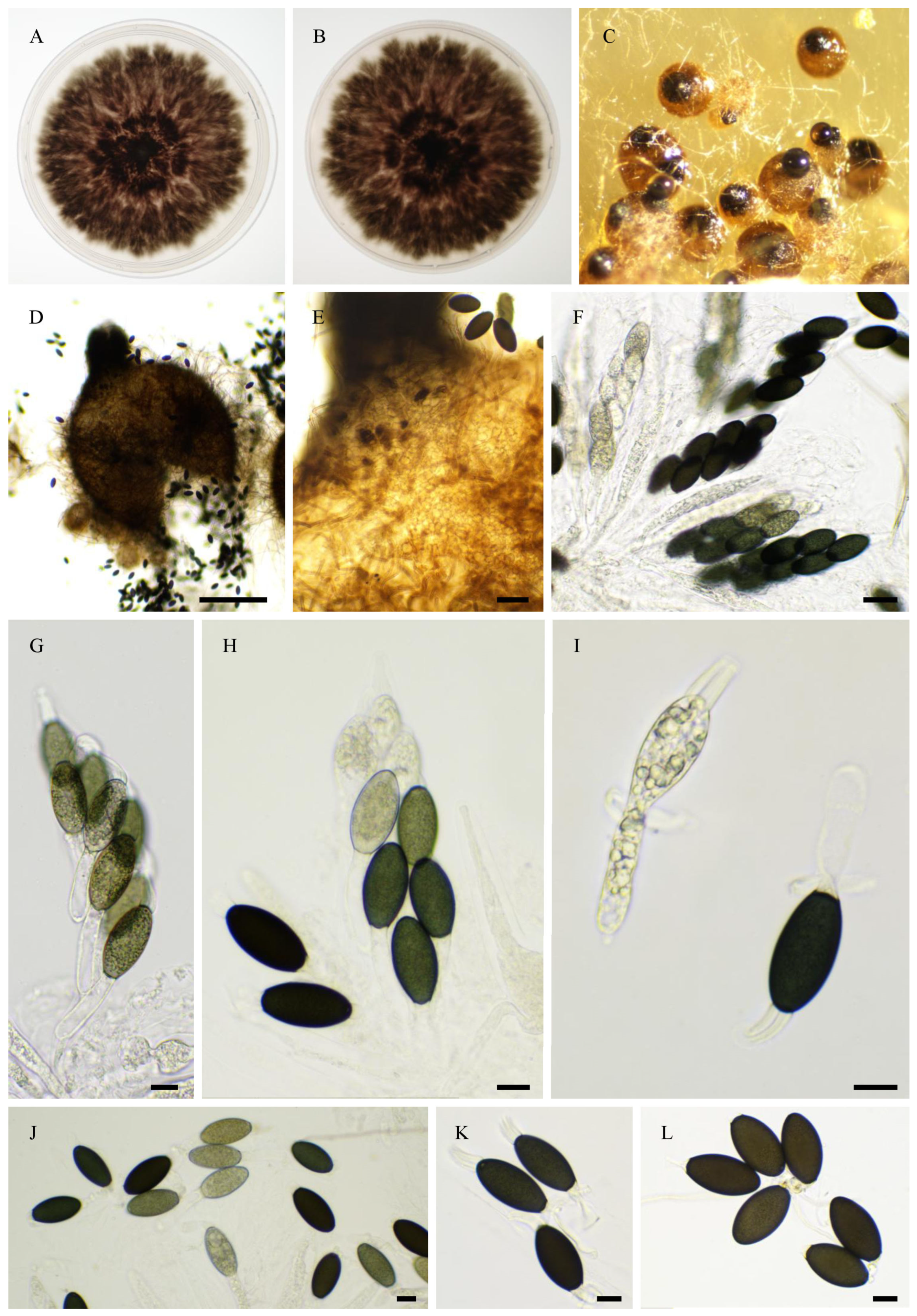 Jof 11 00880 g016 Jof 11 00880 g016