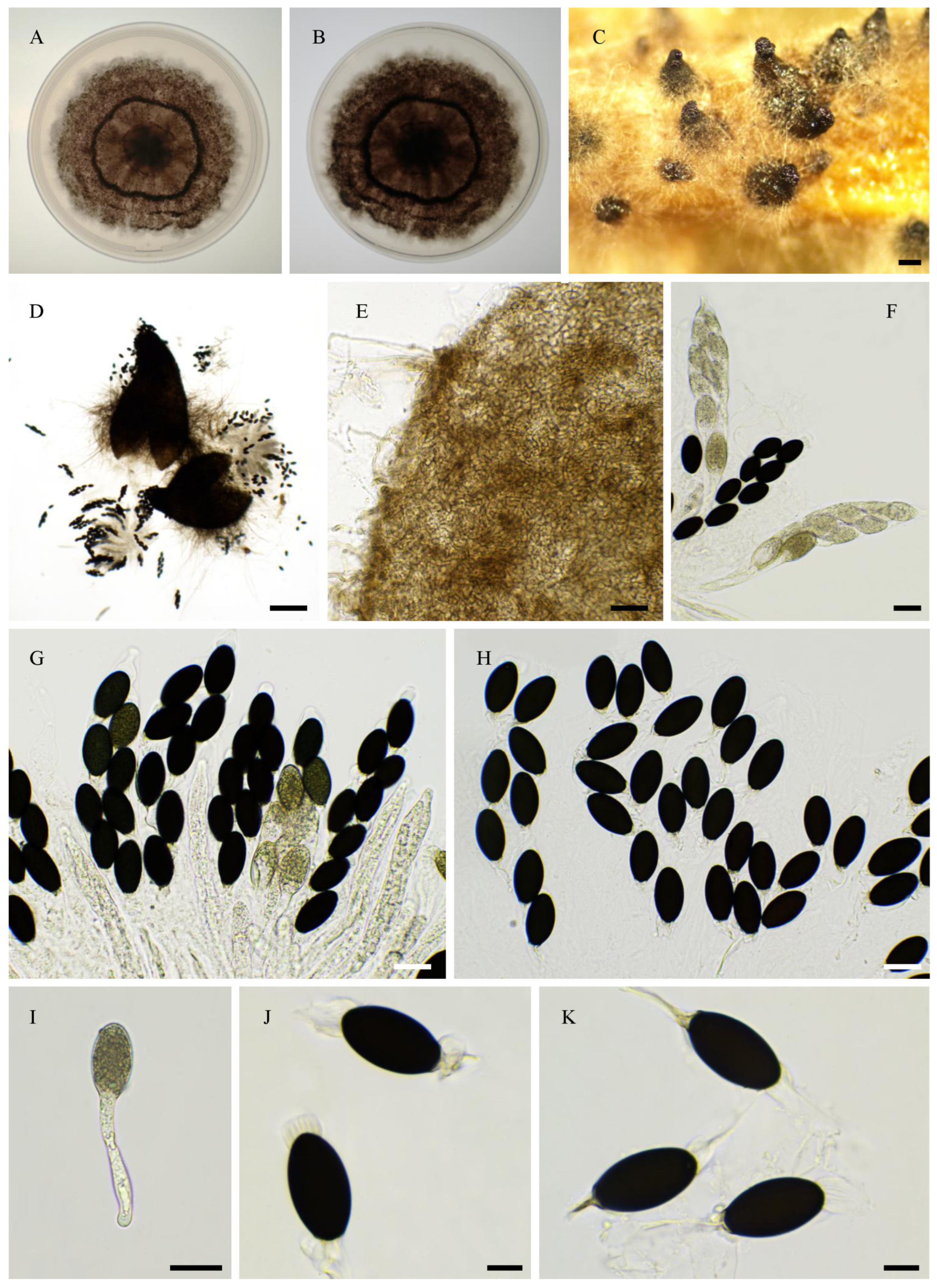 Jof 11 00880 g017 Jof 11 00880 g017