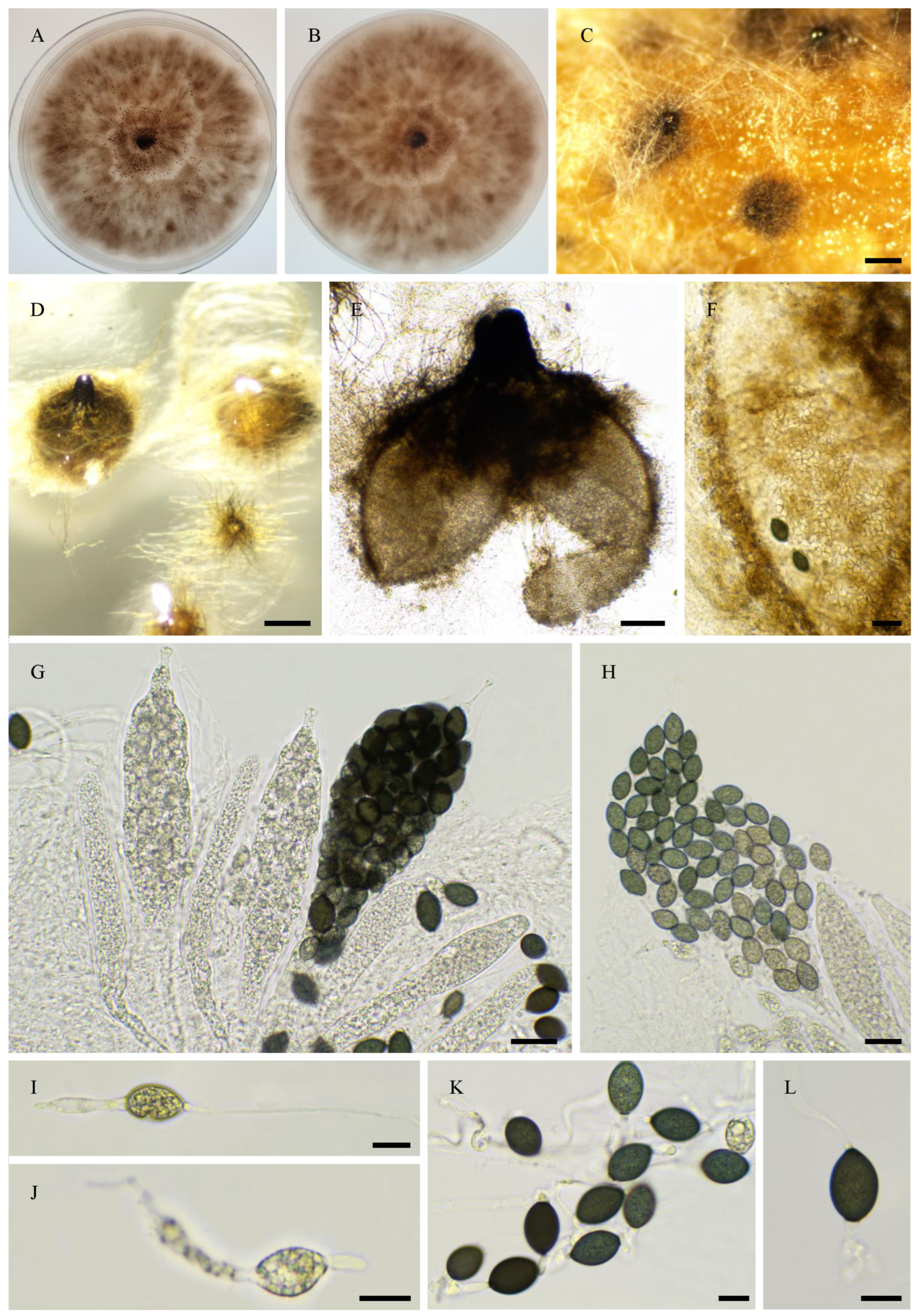 Jof 11 00880 g018 Jof 11 00880 g018