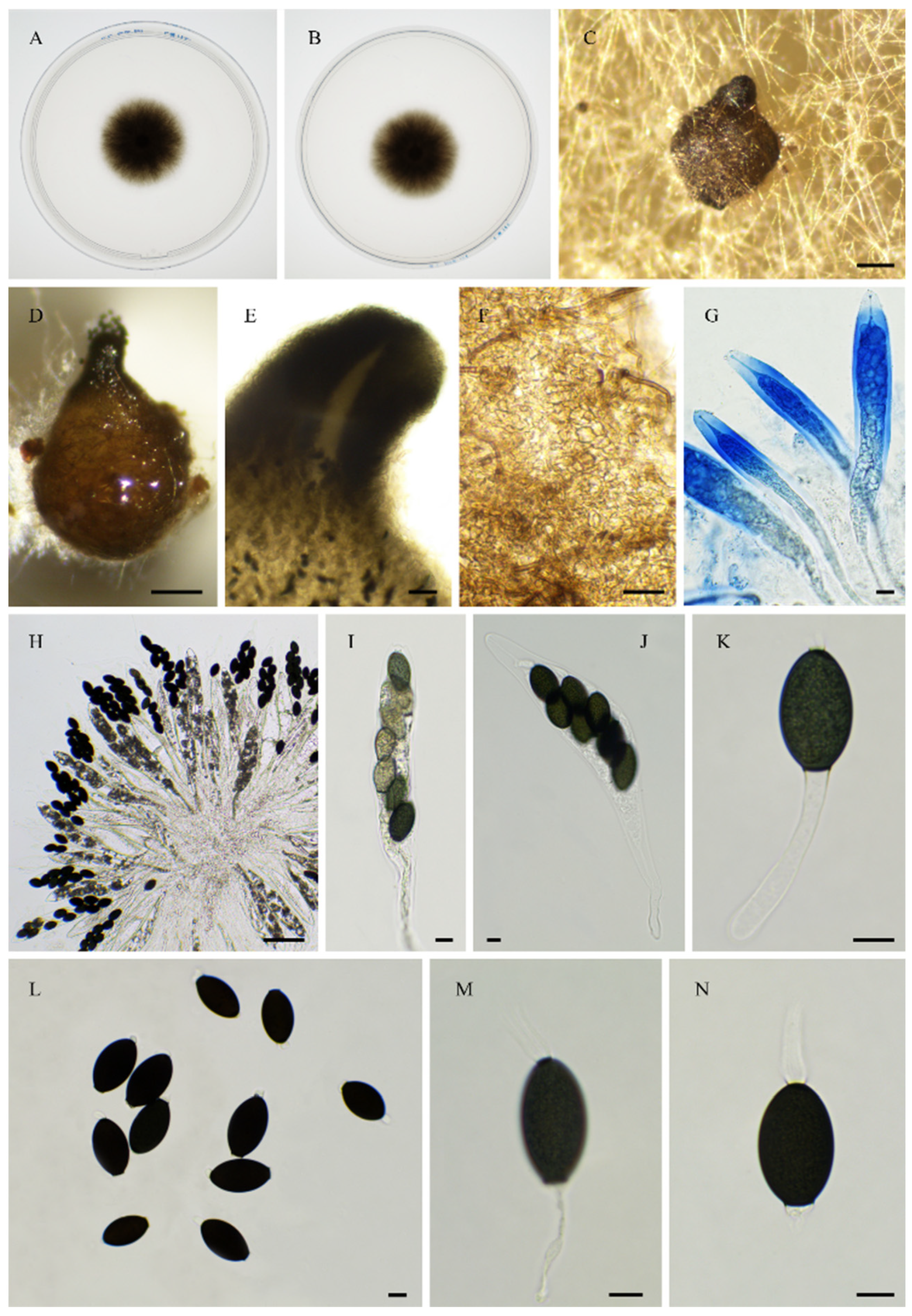 Jof 11 00880 g019 Jof 11 00880 g019