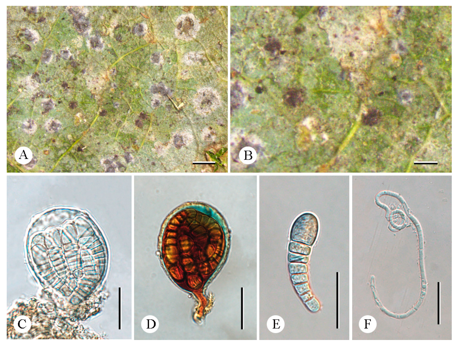 Jof 12 00042 g004 Jof 12 00042 g004