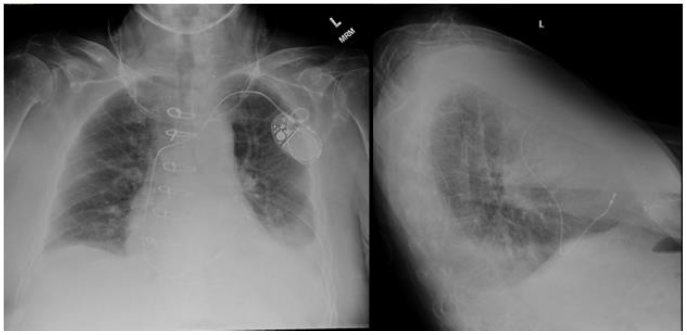 Thoracic Medical Oncology BIDMC on X:  / X