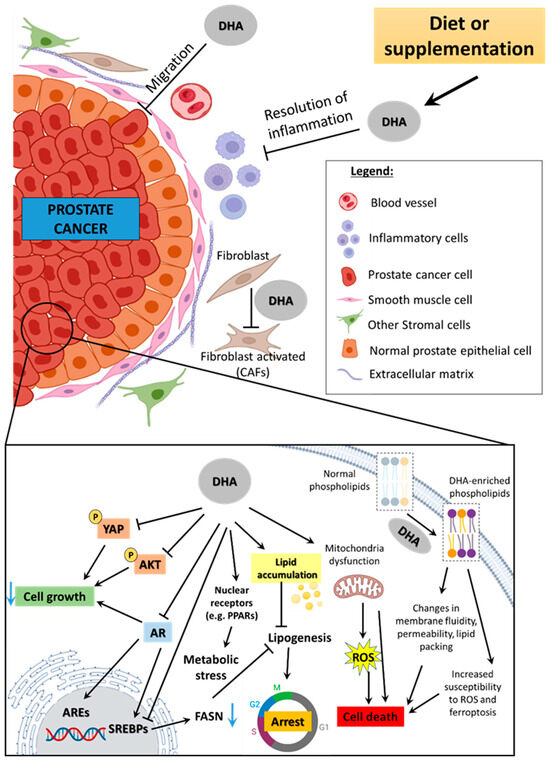 does dihexa cause cancer Effects of Docosahexaenoic Acid on Prostate Cancer