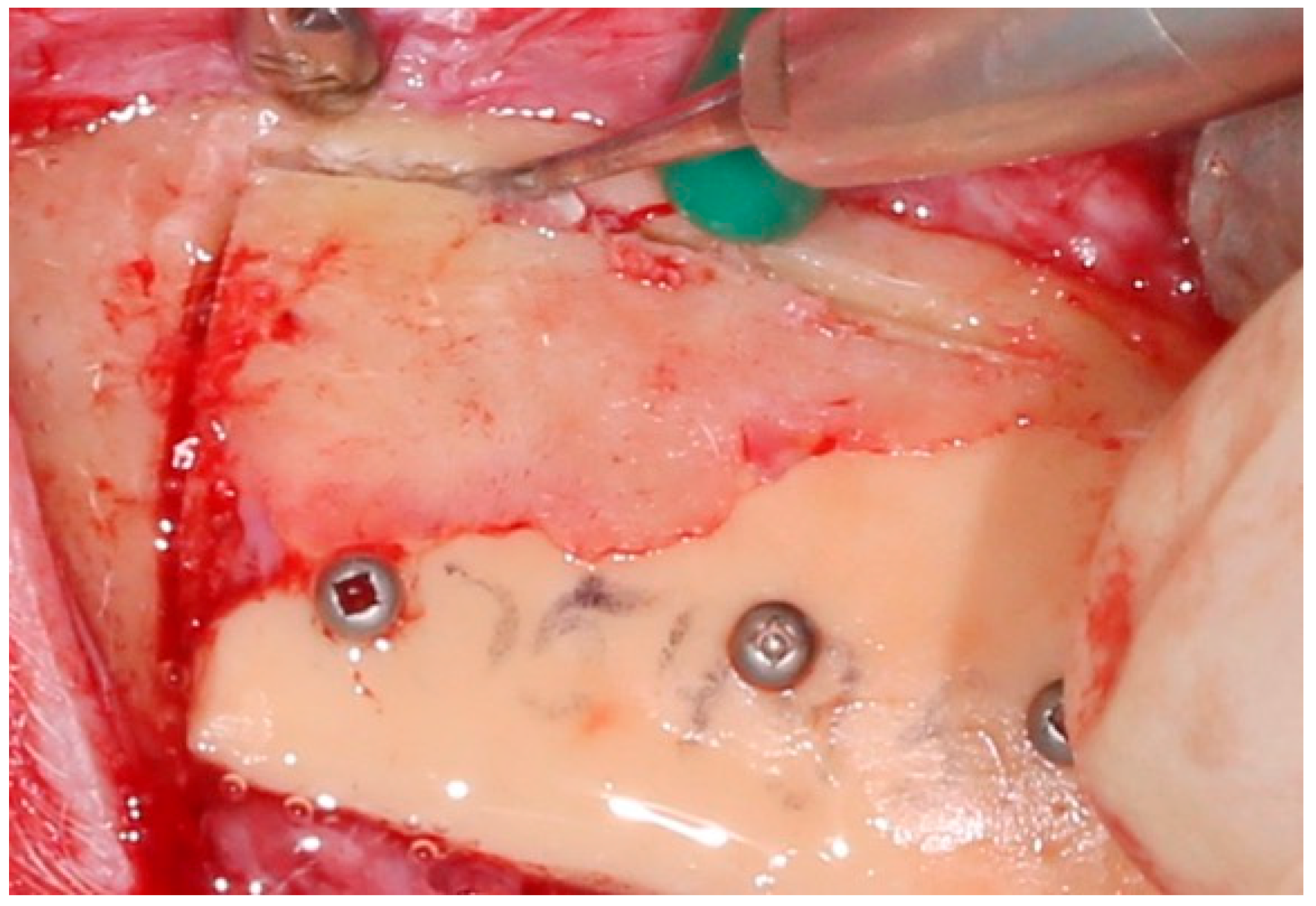 Jpm 10 00006 g004 550