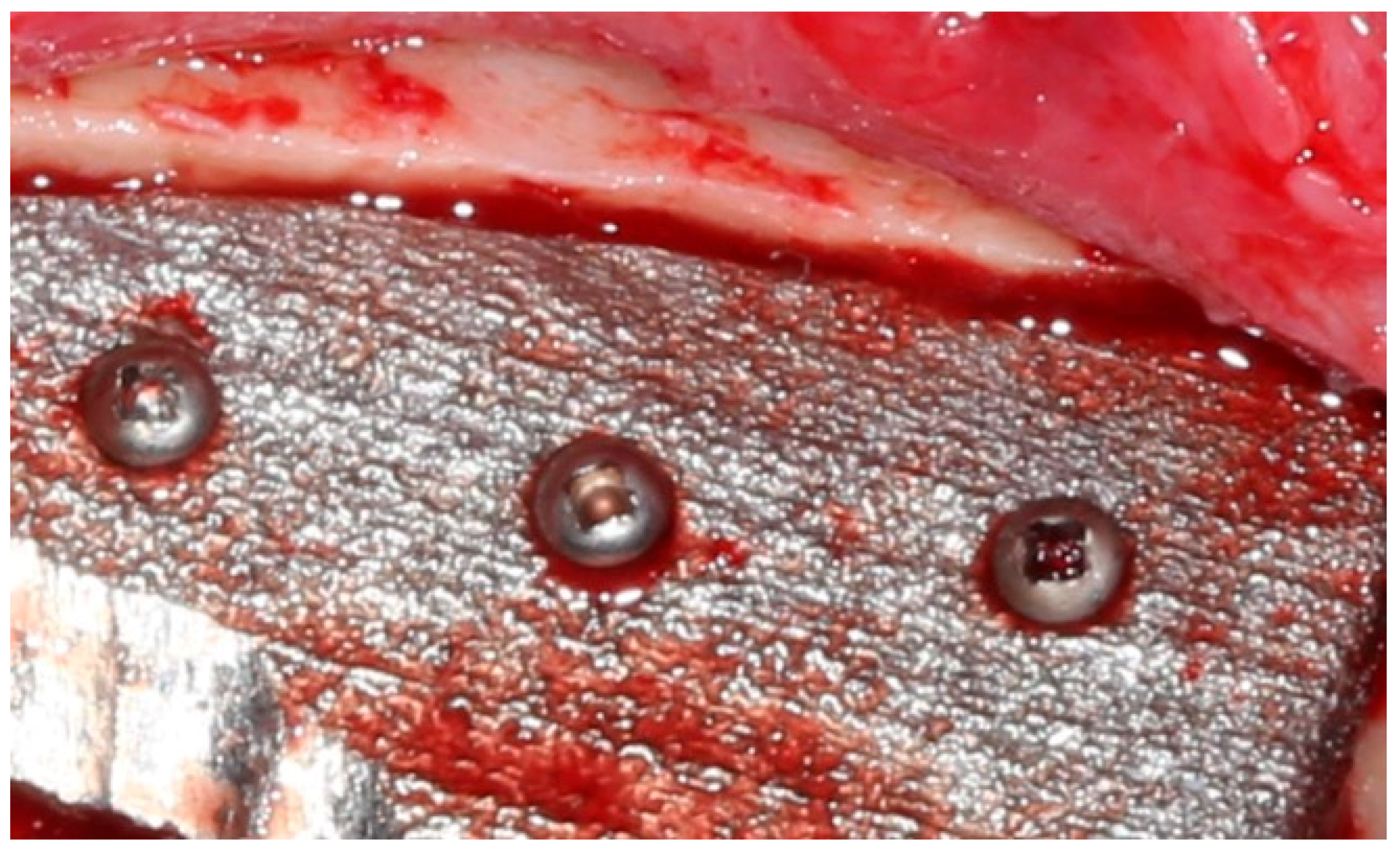 Jpm 10 00006 g005 550