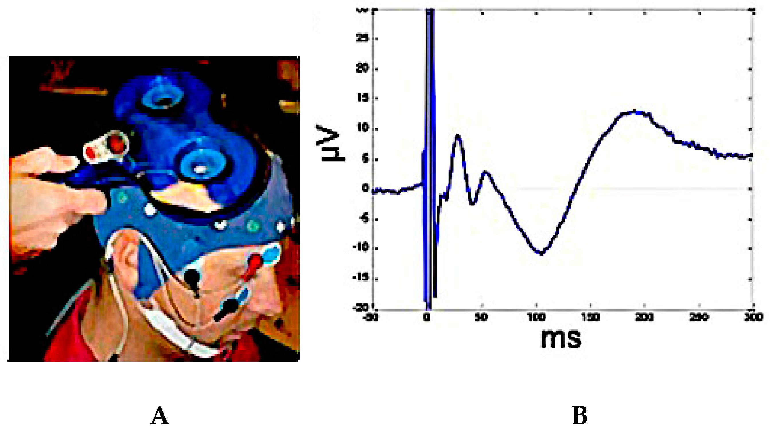 Jpm 10 00034 g003 Jpm 10 00034 g003