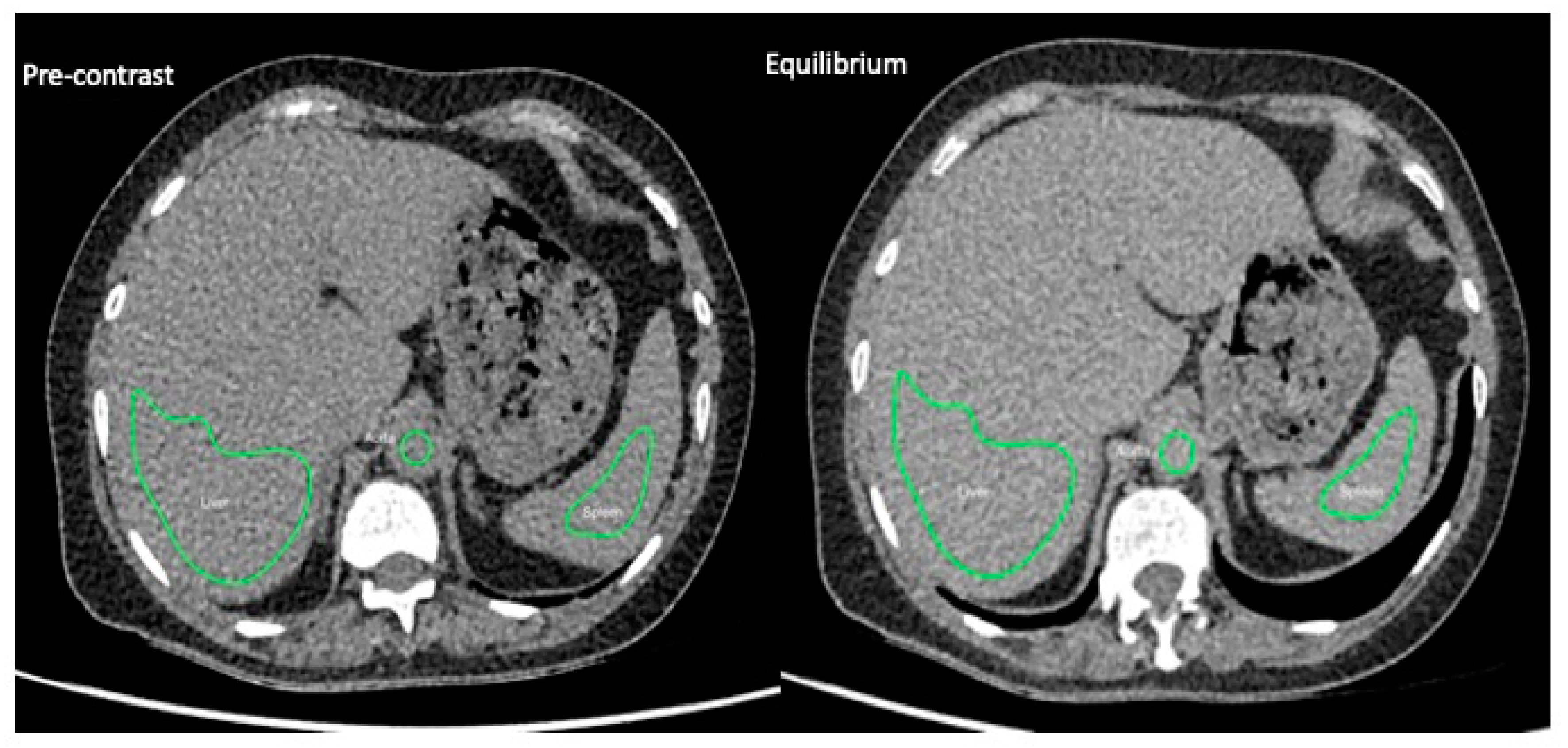 Jpm 10 00046 g002 Jpm 10 00046 g002