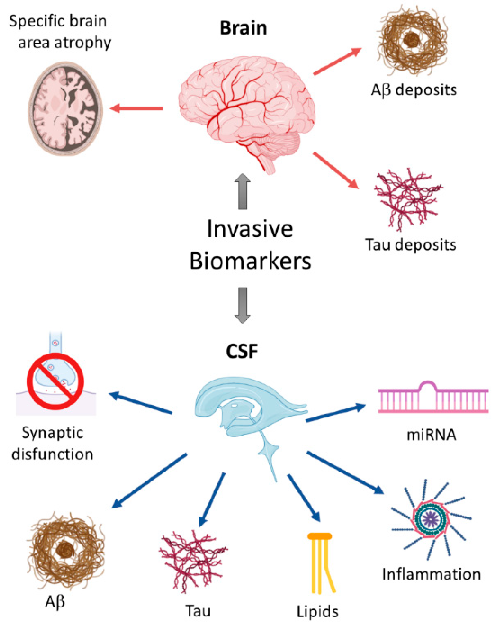 Early identification of Alzheimer's disease in mouse models