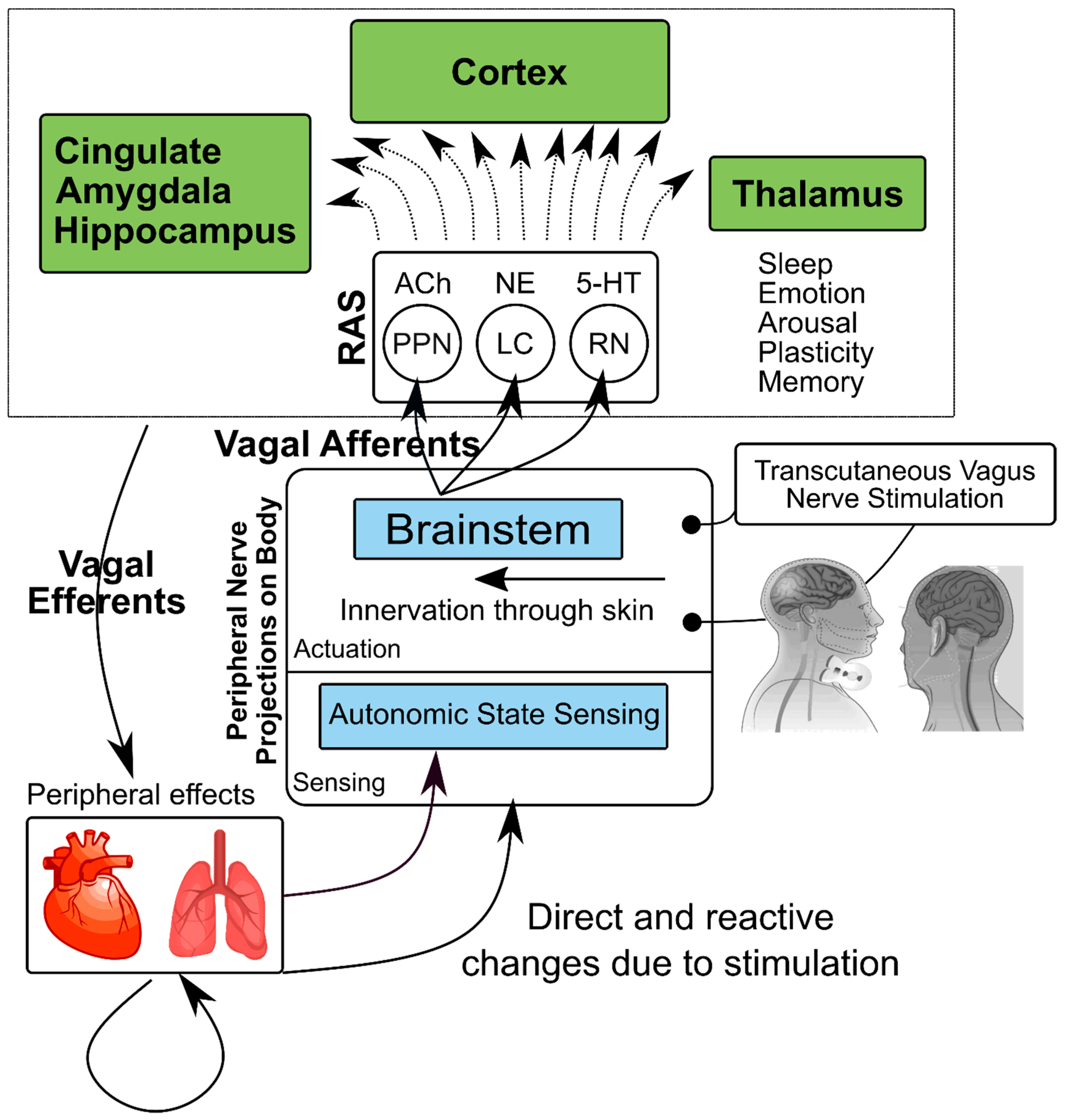 Placement of vagus nerve stimulation device. As illustrated in the