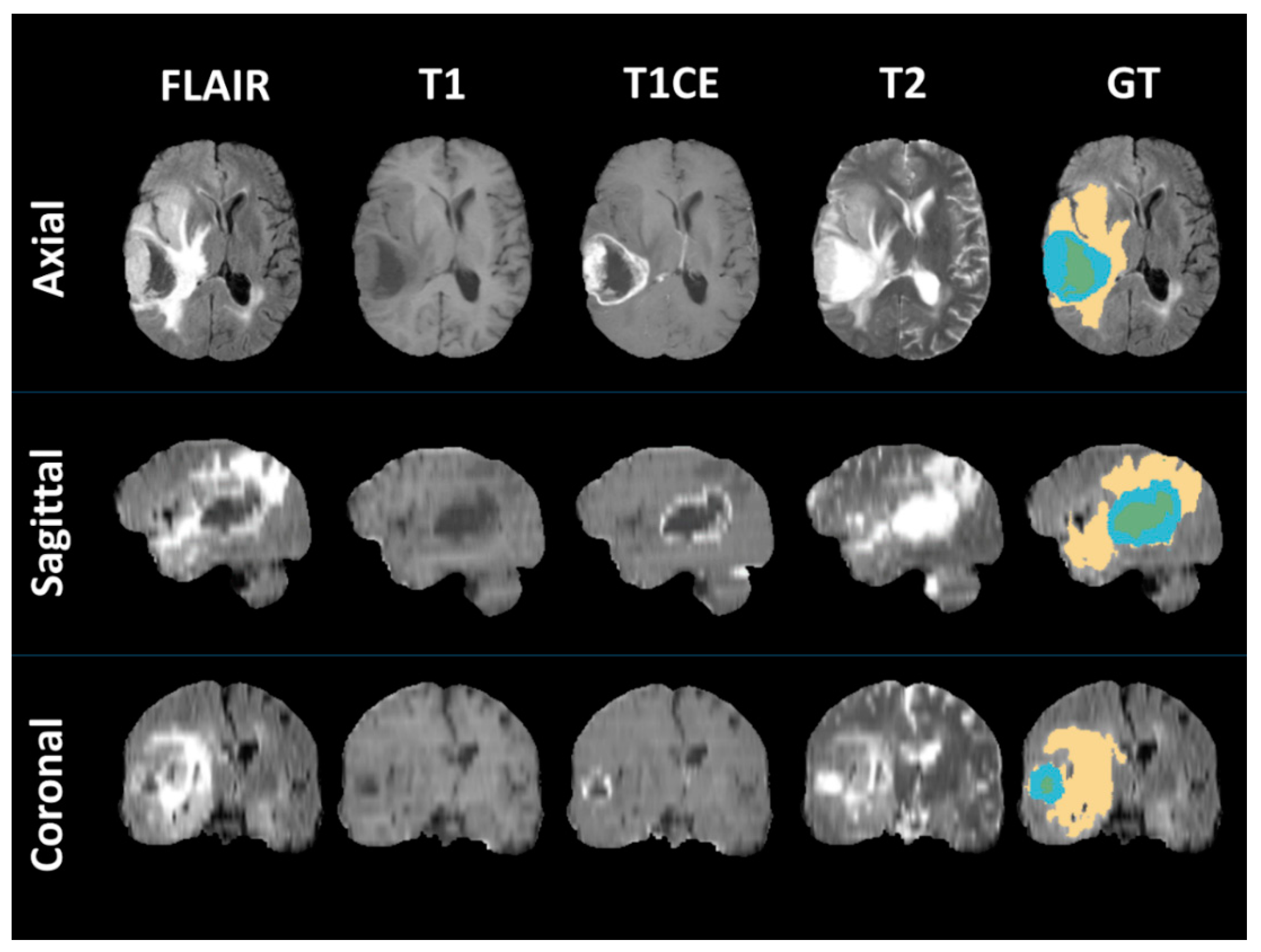 Jpm 10 00128 g003 Jpm 10 00128 g003