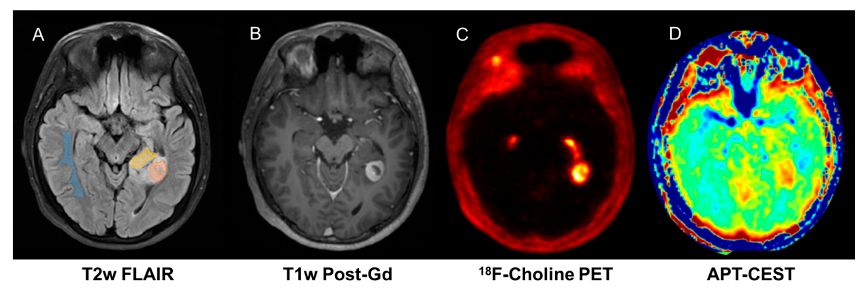 Jpm 10 00218 g003 Jpm 10 00218 g003