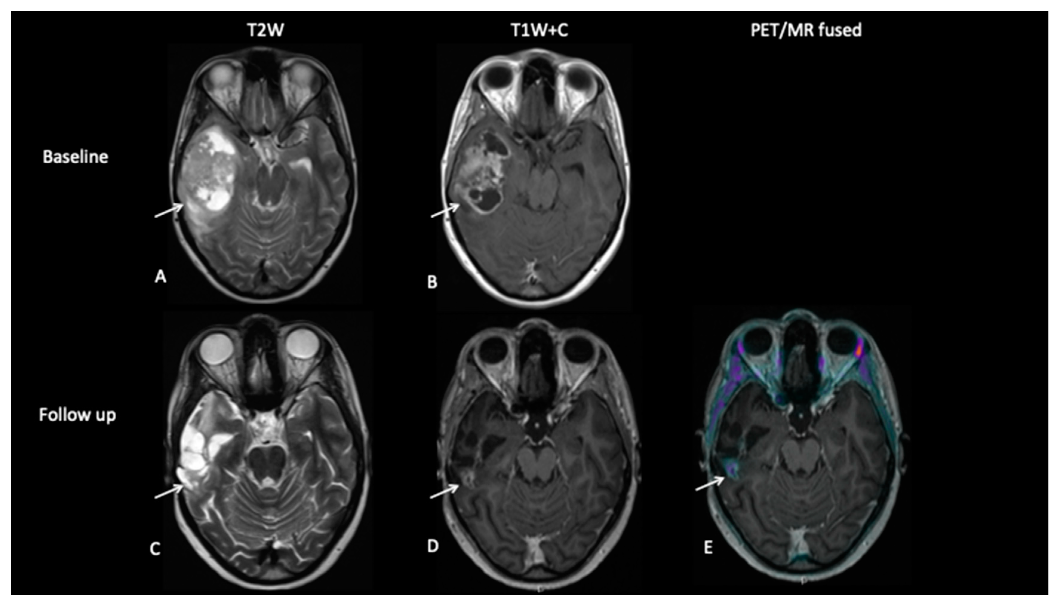 Jpm 10 00218 g008 Jpm 10 00218 g008