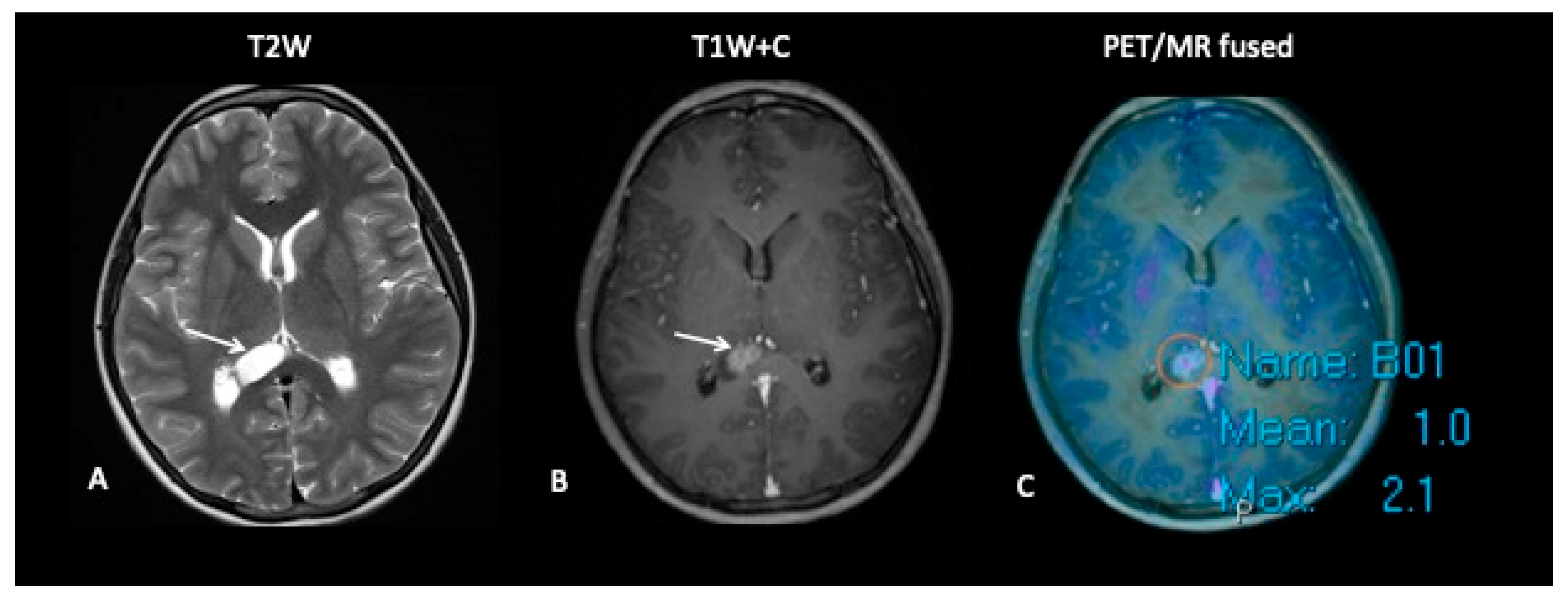 Jpm 10 00218 g011 Jpm 10 00218 g011
