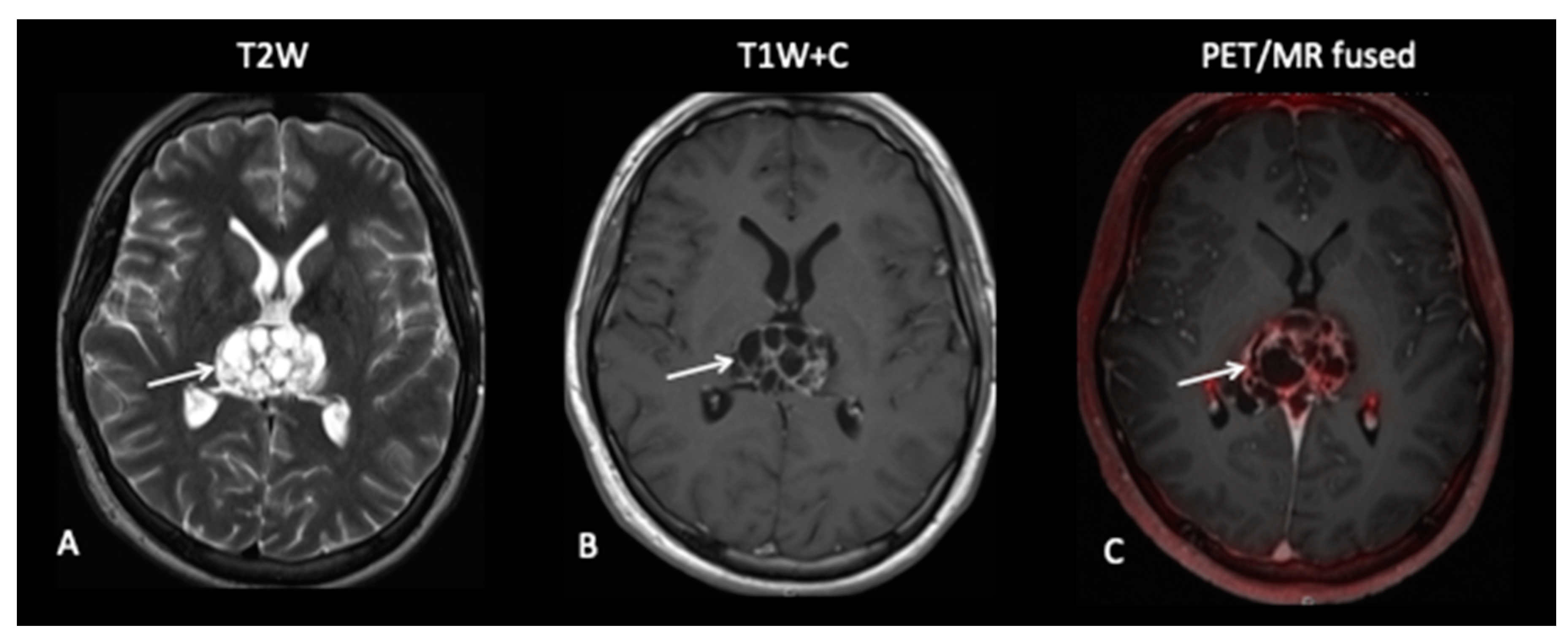Jpm 10 00218 g012 Jpm 10 00218 g012