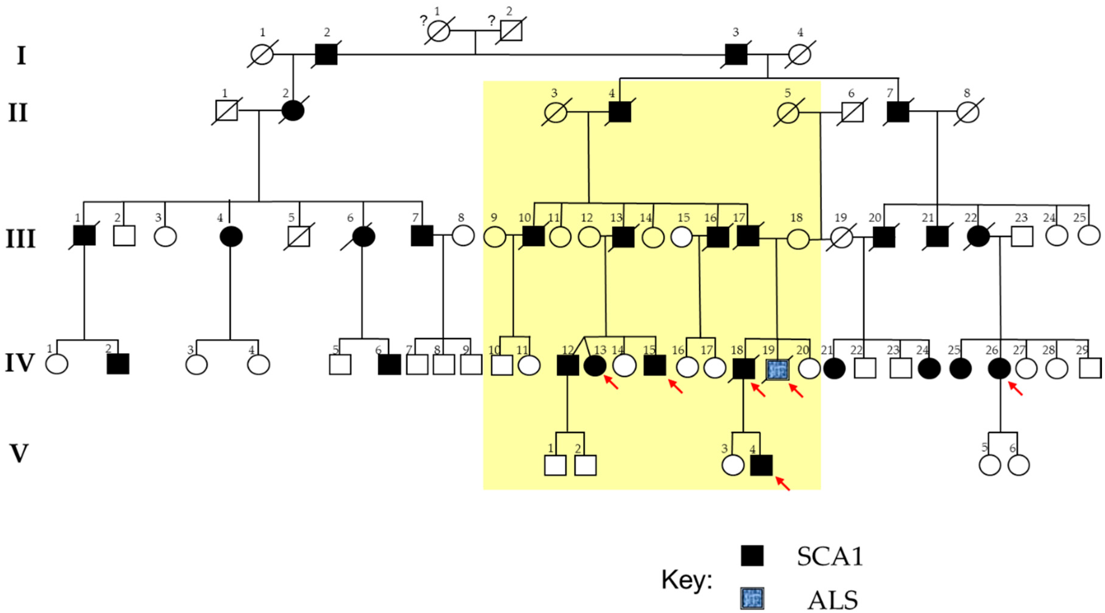 jpm free full text genomic portrait of a sporadic amyotrophic lateral sclerosis case in a large spinocerebellar ataxia type 1 family html