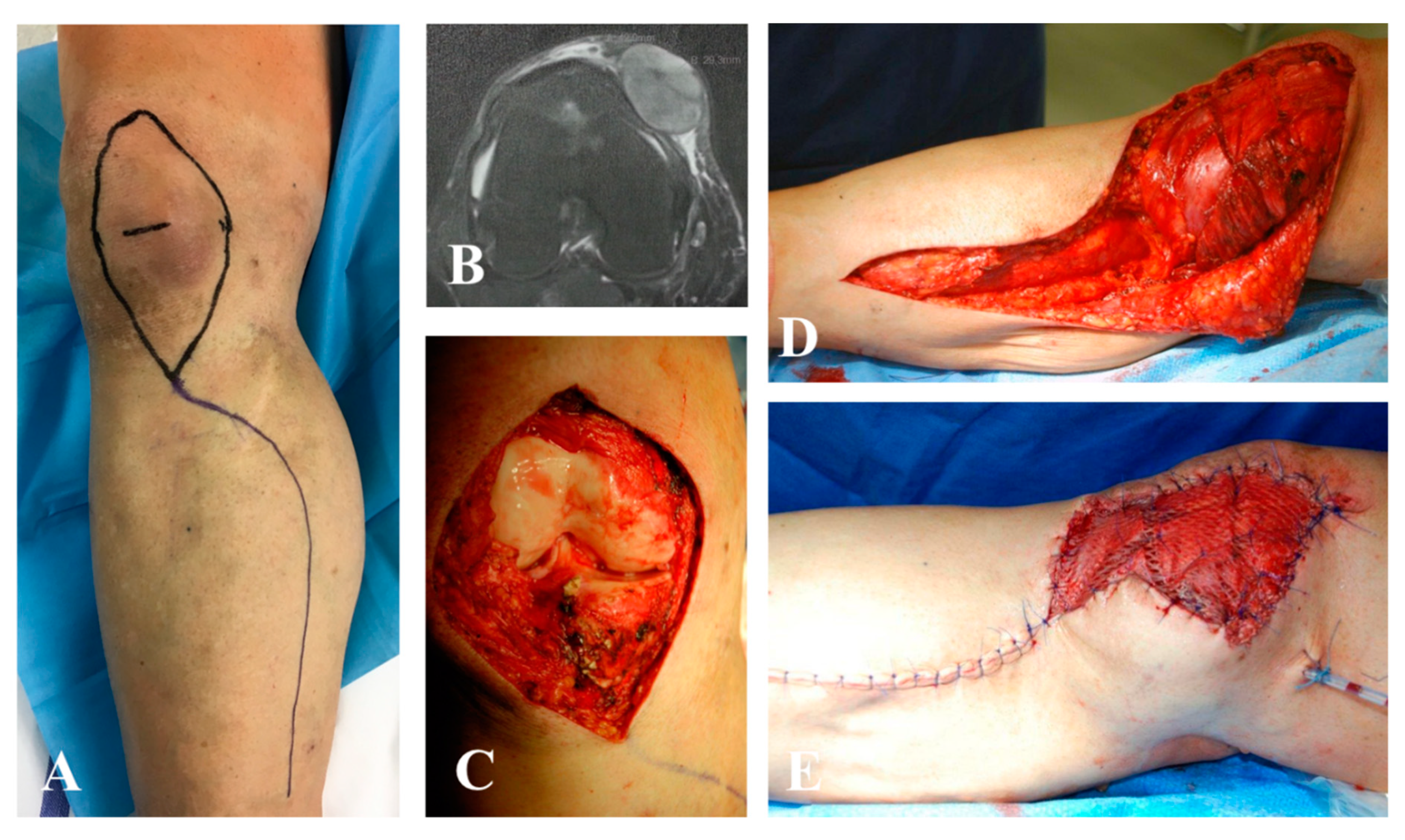 Jpm 10 00278 g002a Jpm 10 00278 g002a