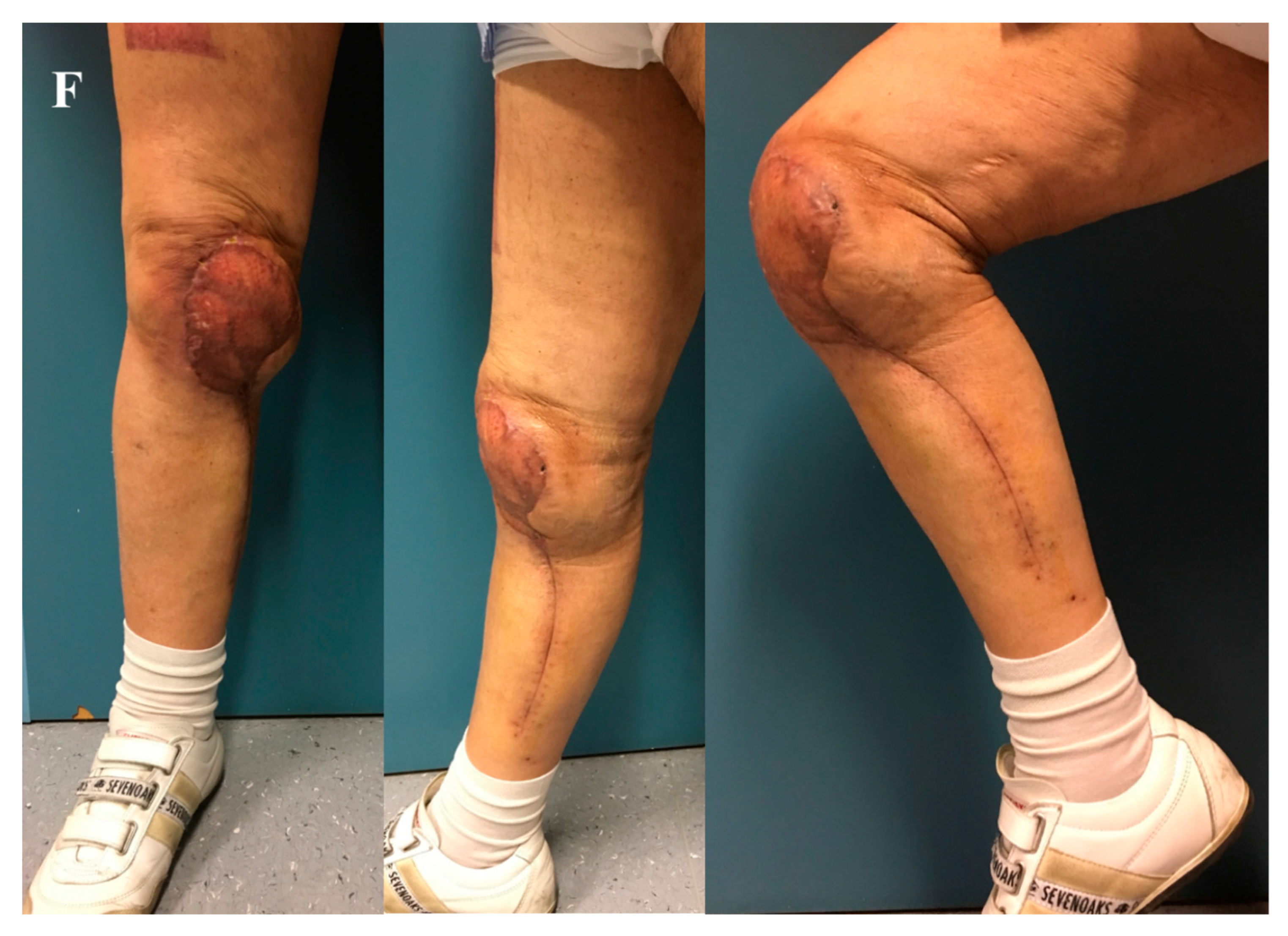 Jpm 10 00278 g002b Jpm 10 00278 g002b