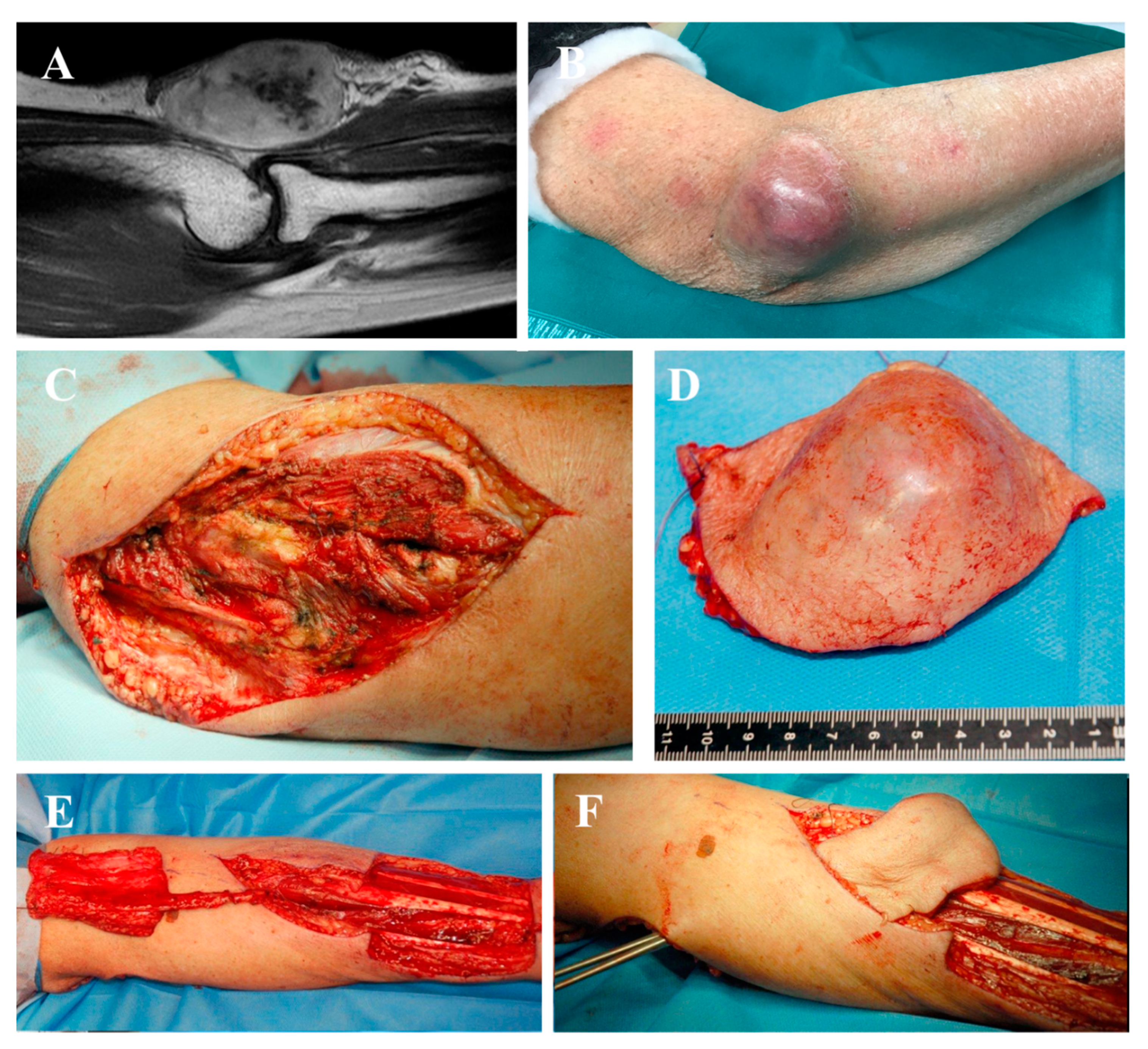 Jpm 10 00278 g003a Jpm 10 00278 g003a