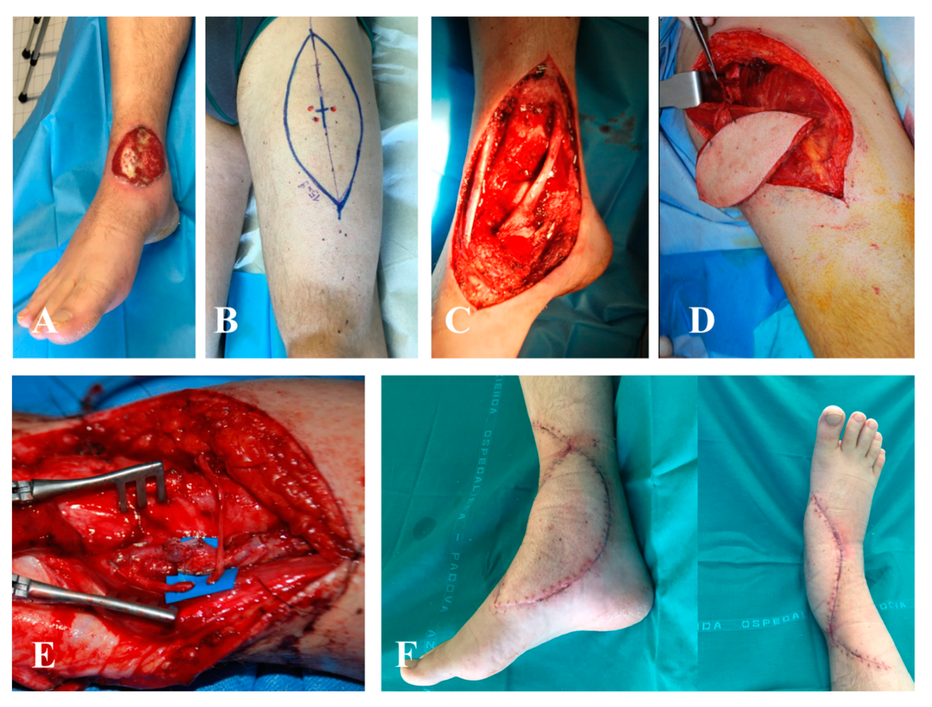 Jpm 10 00278 g004 Jpm 10 00278 g004