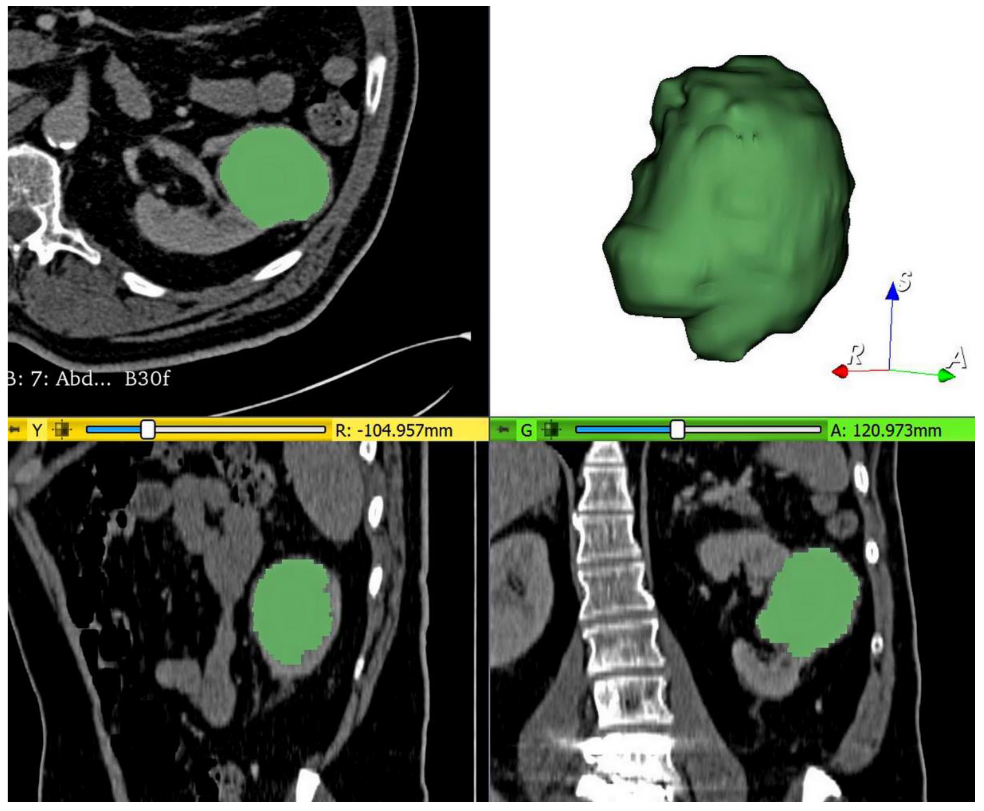 Jpm 11 00008 g001 Jpm 11 00008 g001