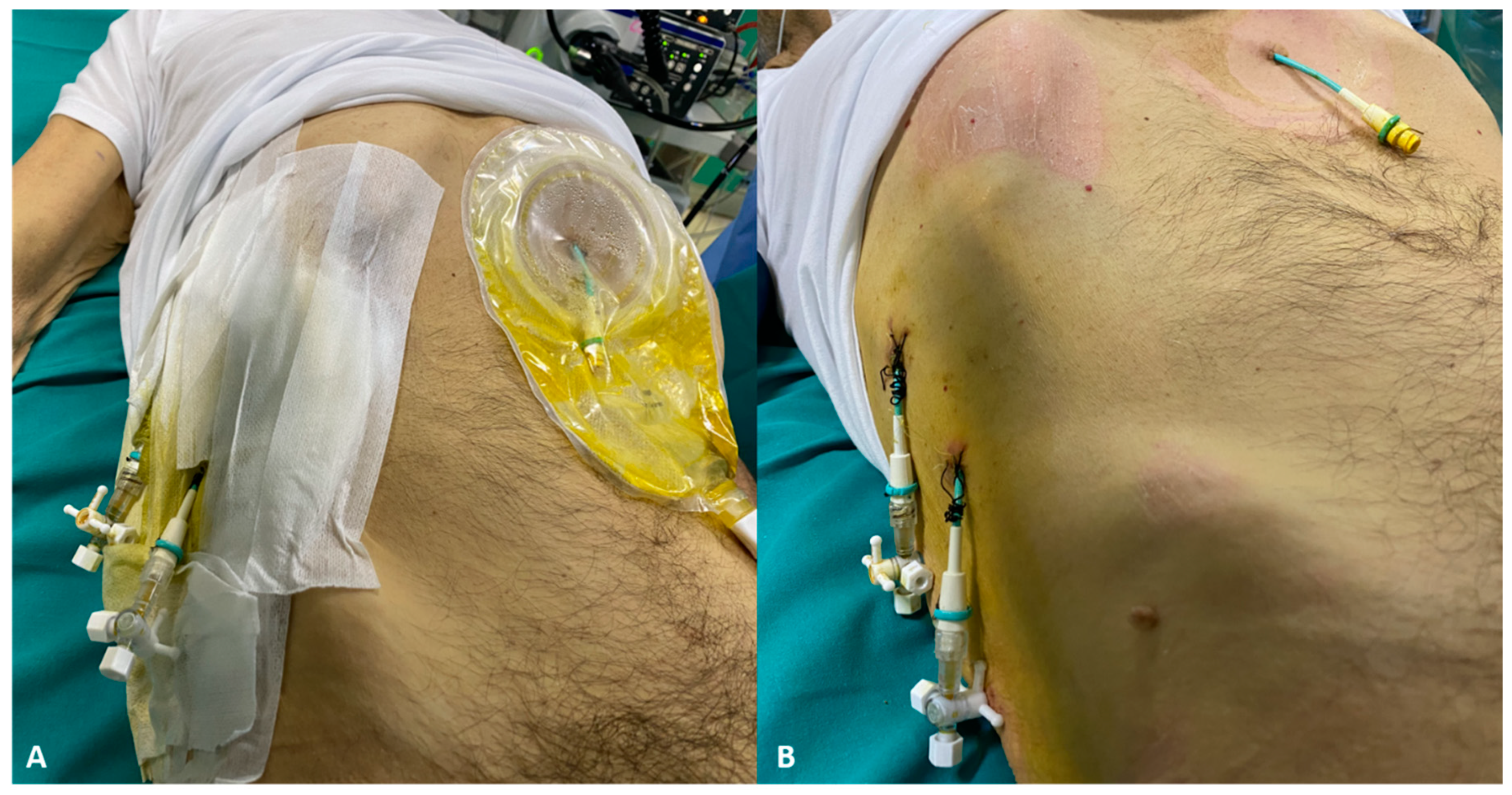 Jpm 11 00078 g004 Jpm 11 00078 g004