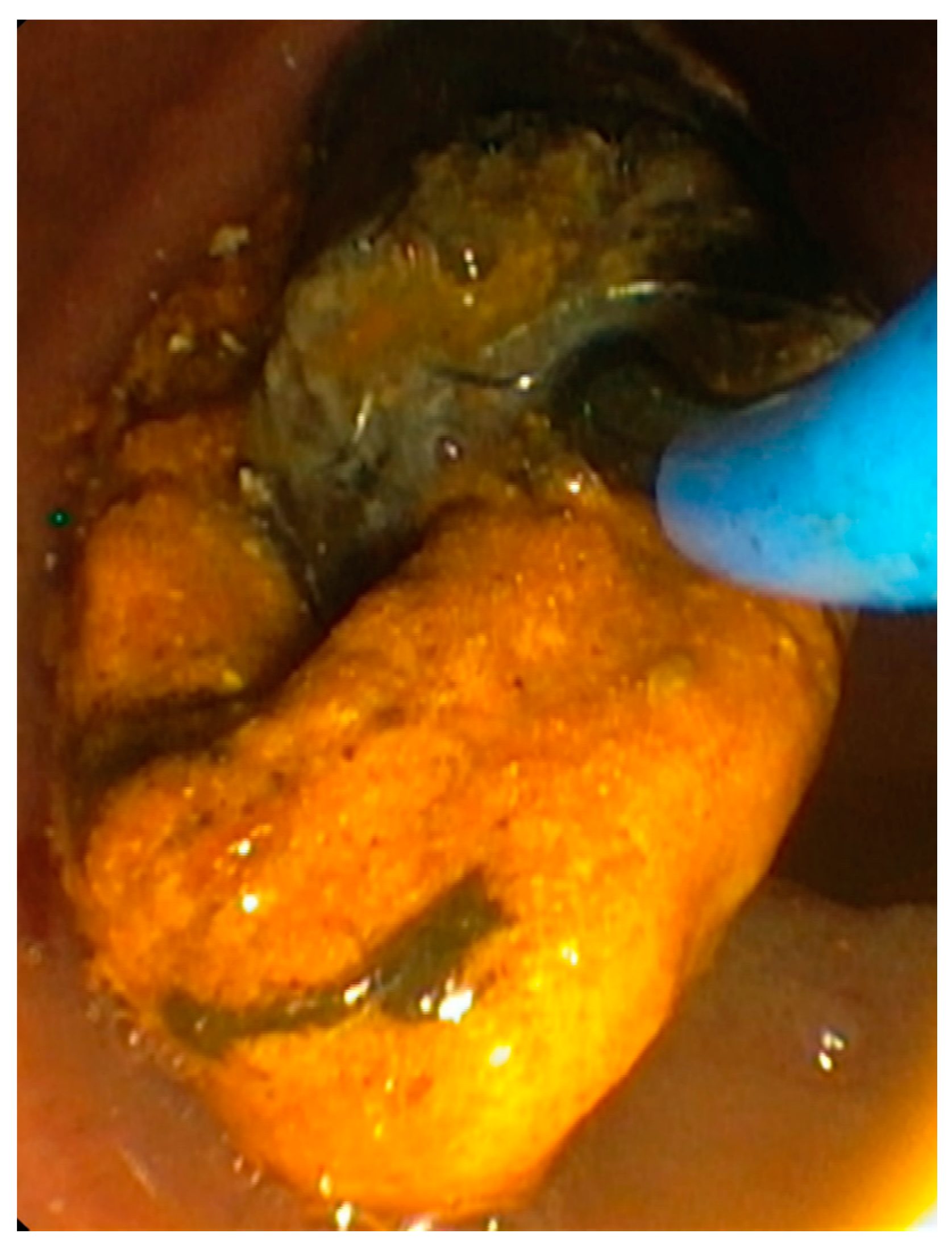 Jpm 11 00078 g006 Jpm 11 00078 g006