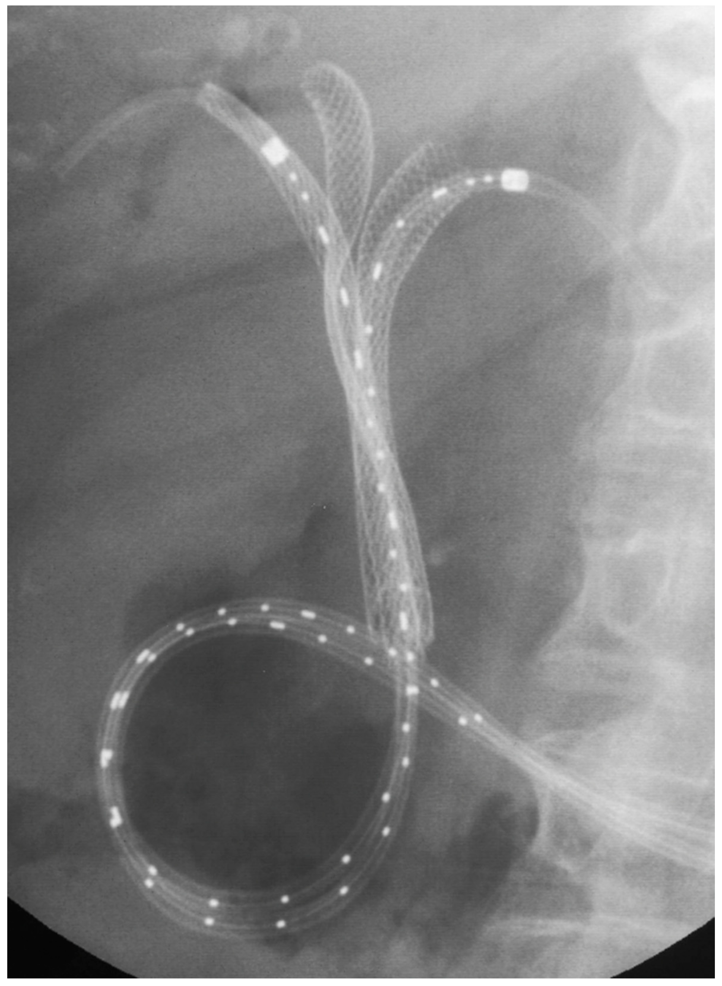 Jpm 11 00078 g009 Jpm 11 00078 g009