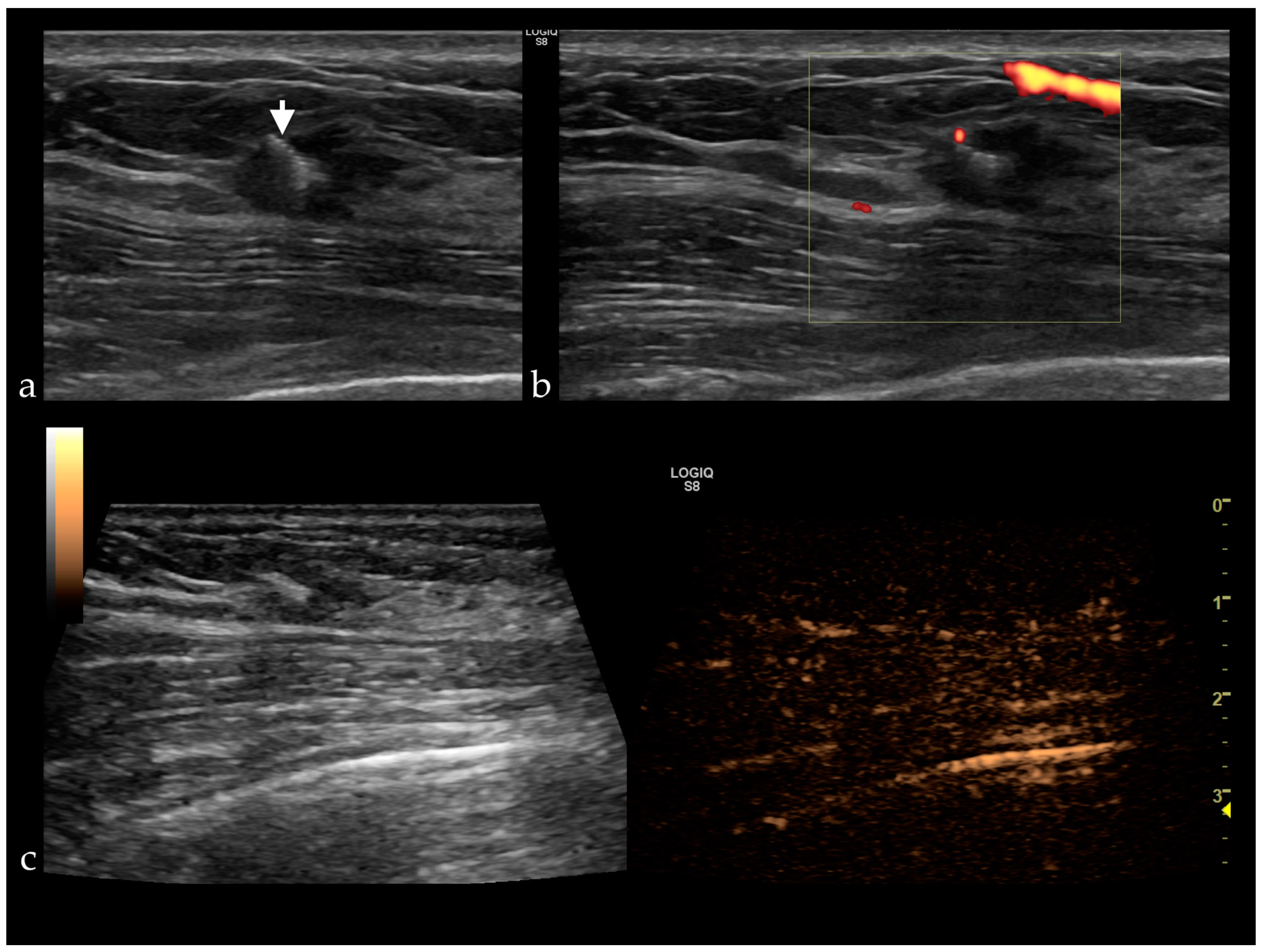 Jpm 11 00081 g002 Jpm 11 00081 g002