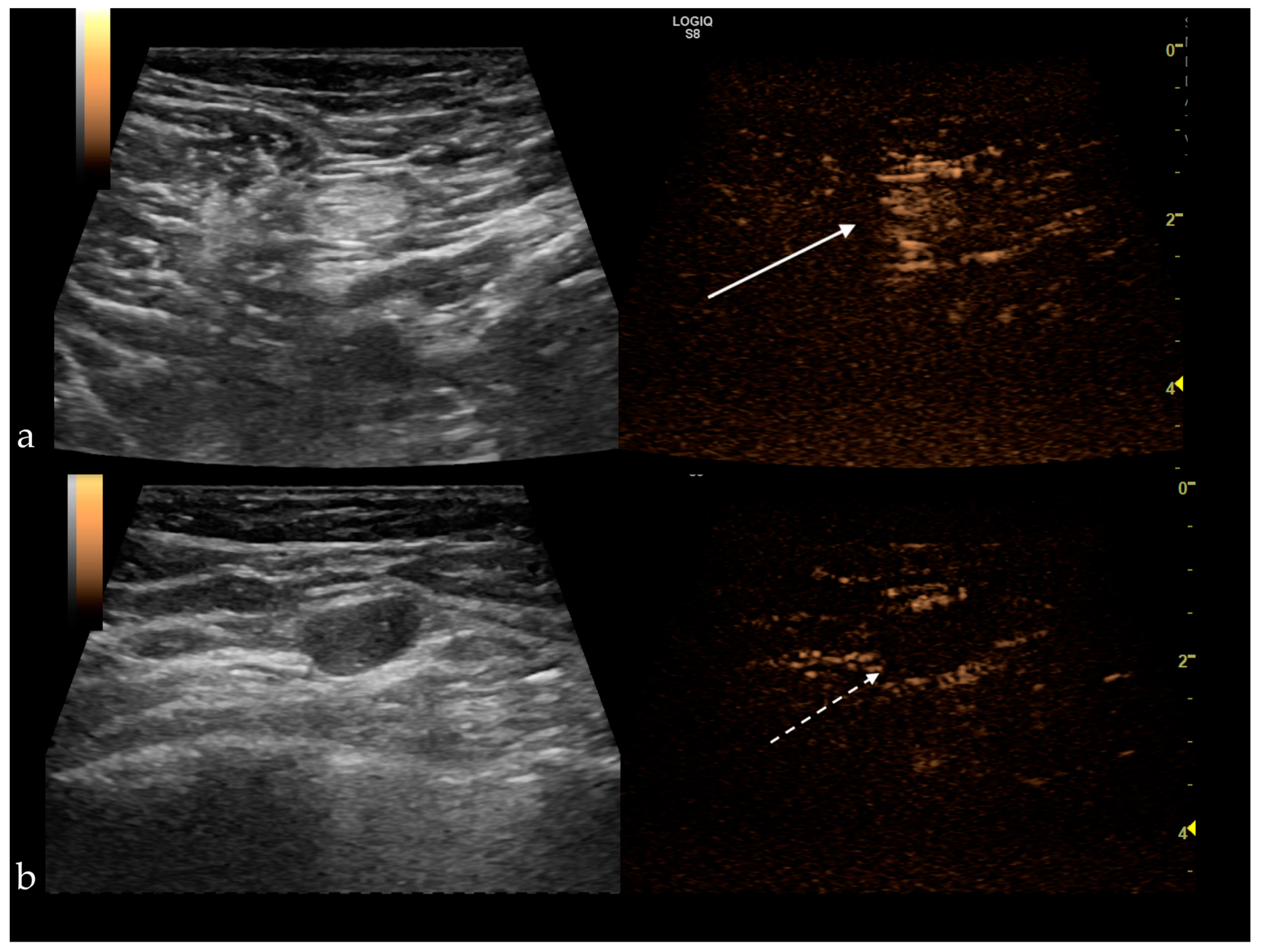 Jpm 11 00081 g004 Jpm 11 00081 g004