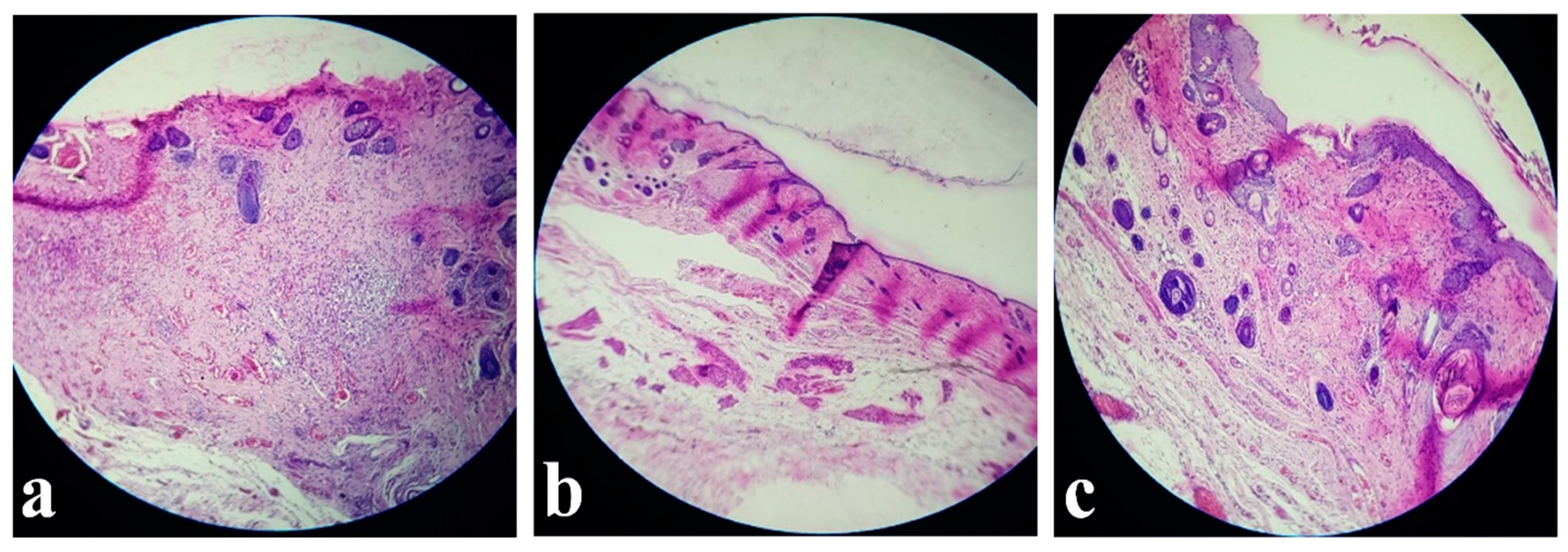 Jpm 11 00147 g003 Jpm 11 00147 g003