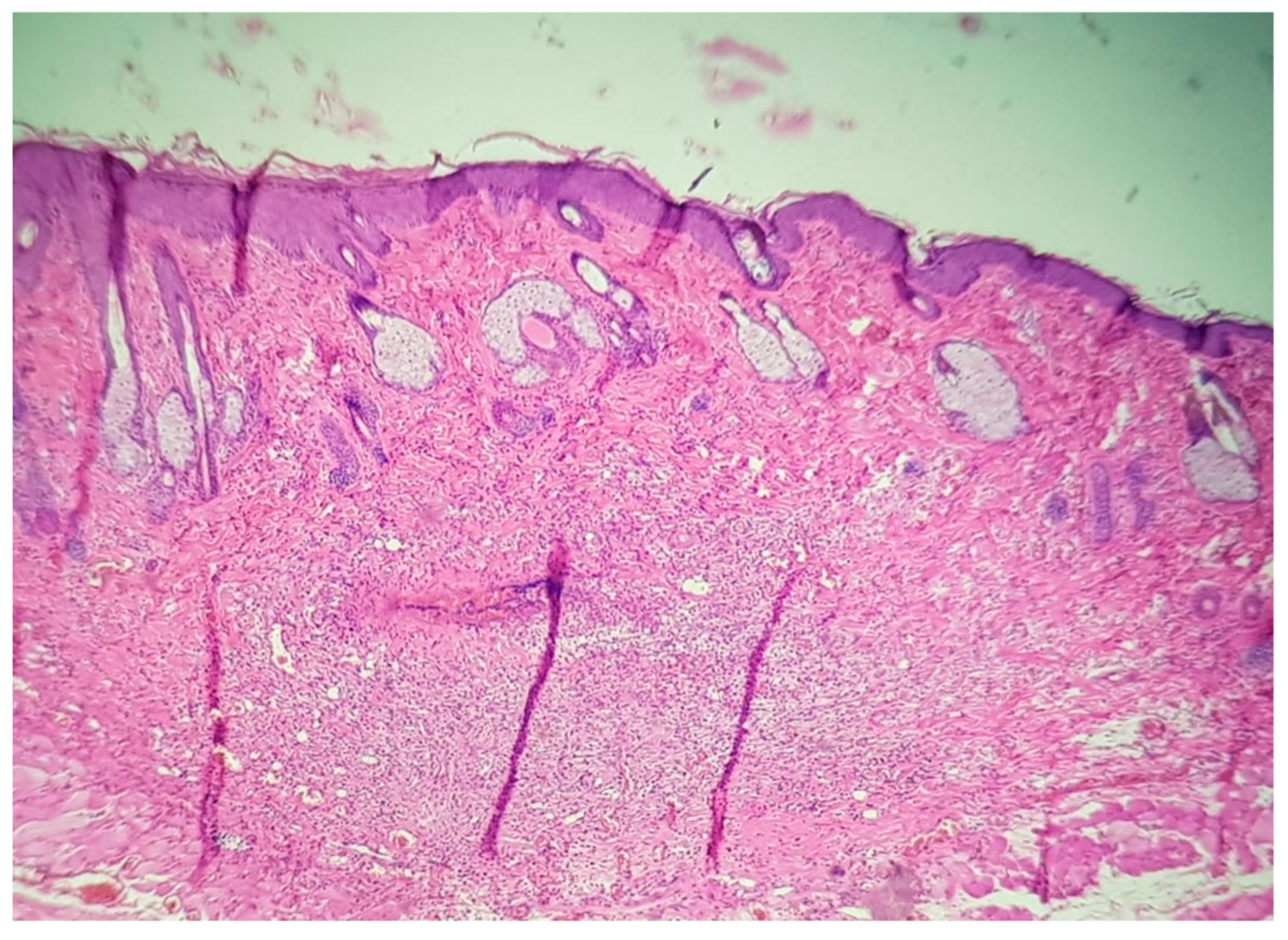 Jpm 11 00147 g006 Jpm 11 00147 g006