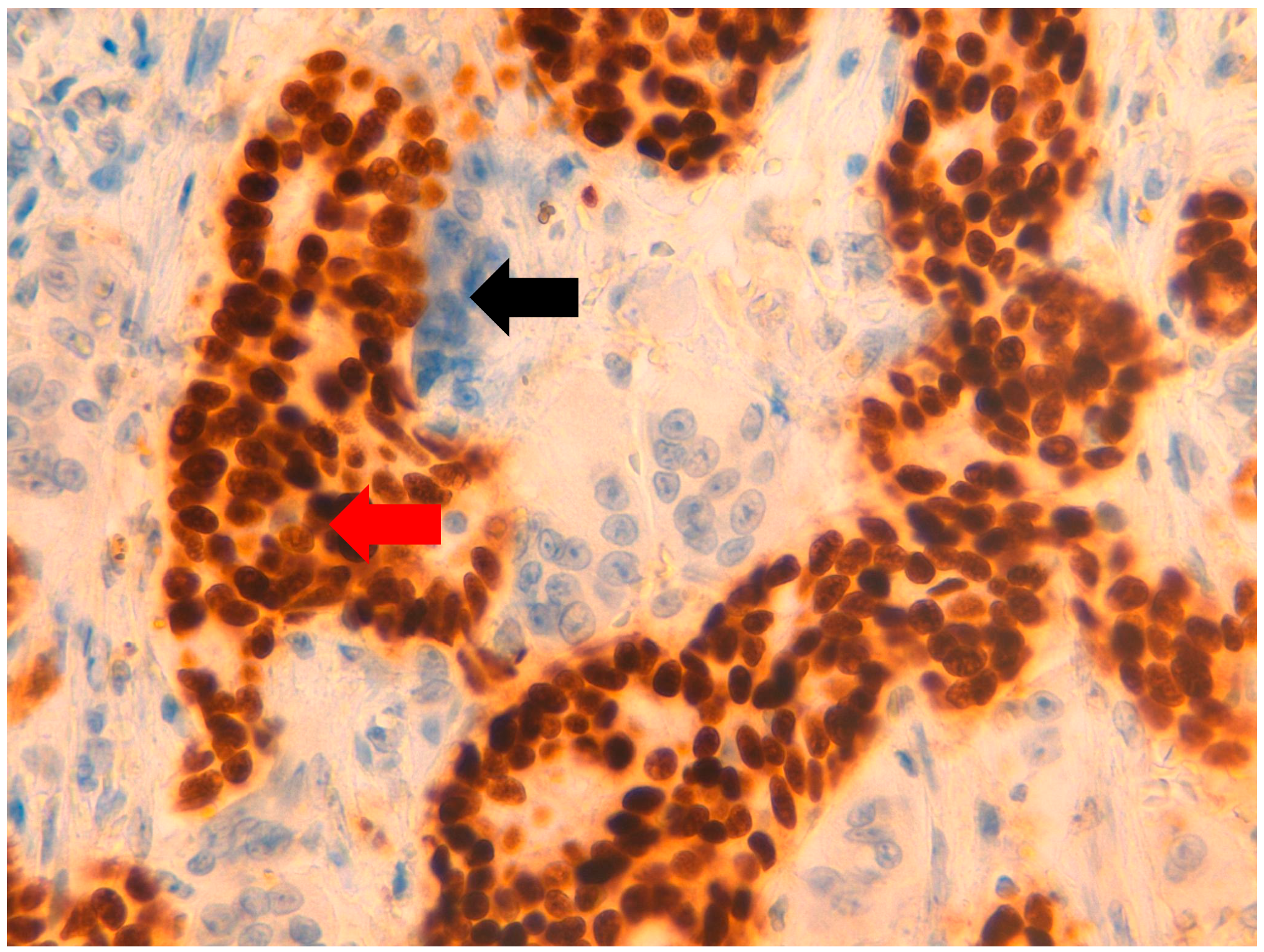 Jpm 11 00156 g006 Jpm 11 00156 g006