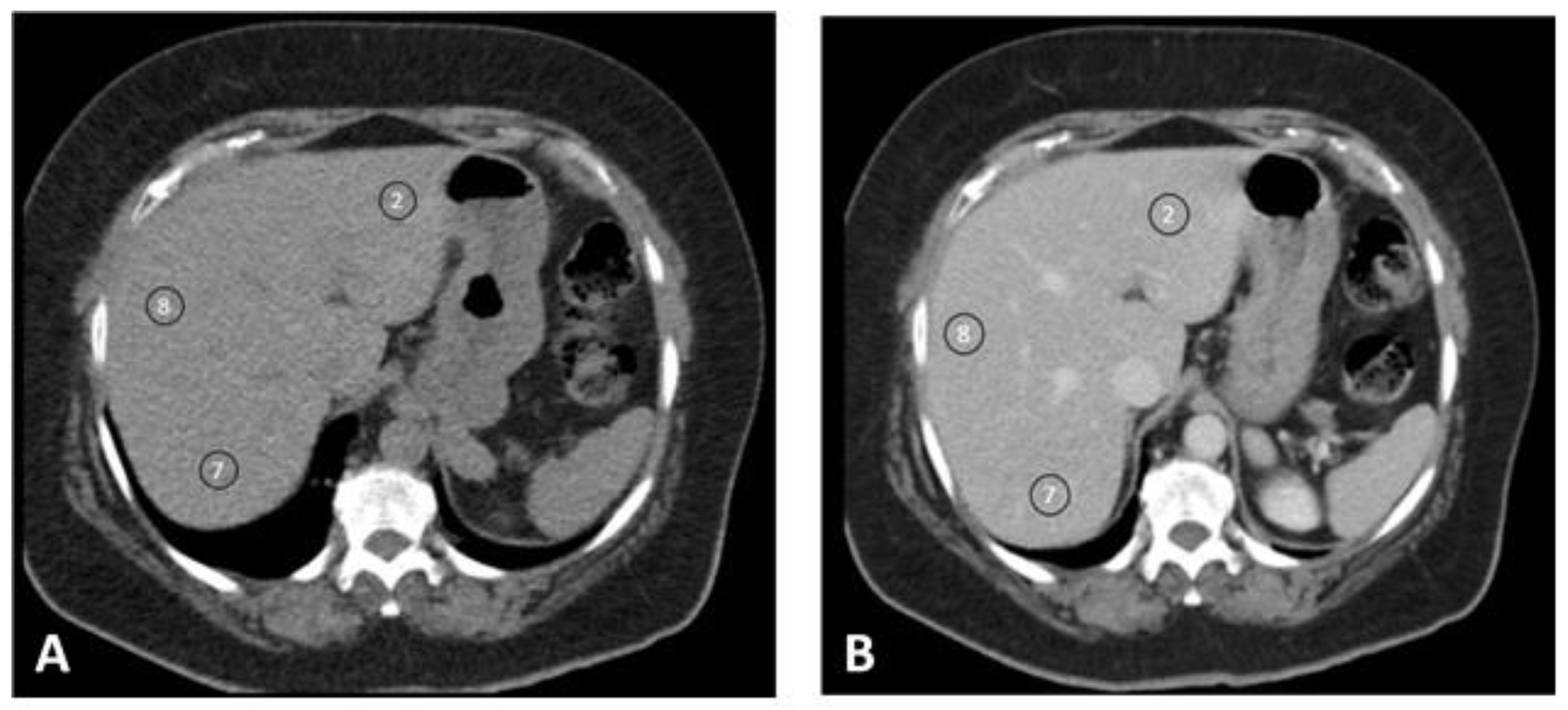 Jpm 11 00159 g002 Jpm 11 00159 g002