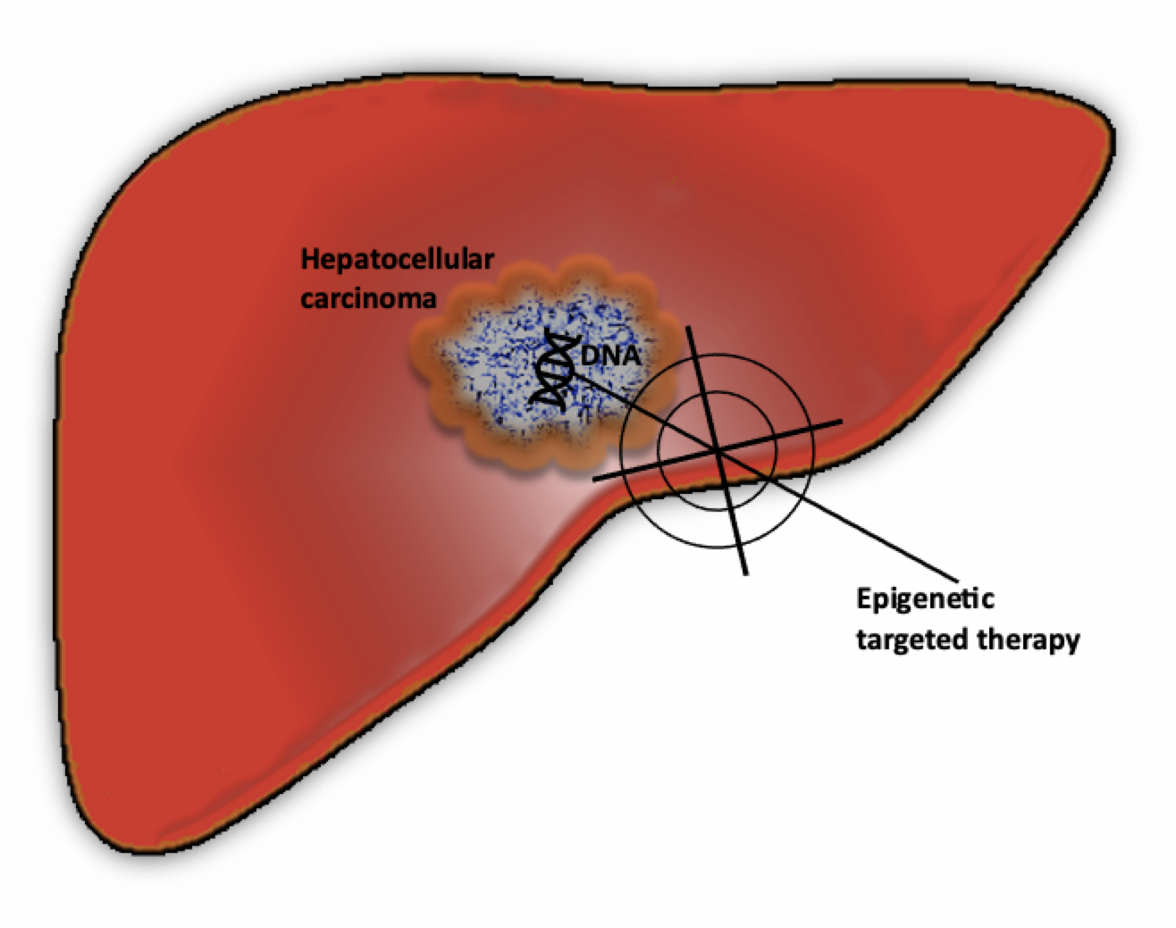 Jpm Free Full Text Histone Deacetylase Inhibitors In The Treatment Of Hepatocellular Carcinoma Current Evidence And Future Opportunities Html Jpm Free Full Text Histone Deacetylase Inhibitors In The Treatment Of Hepatocellular Carcinoma Current Evidence And Future Opportunities Html