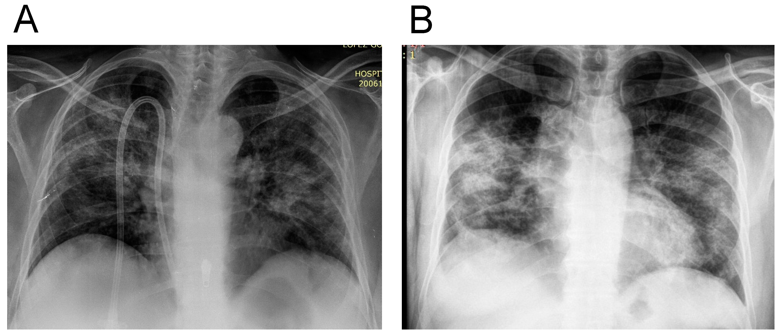 Jpm 11 00224 g001 Jpm 11 00224 g001