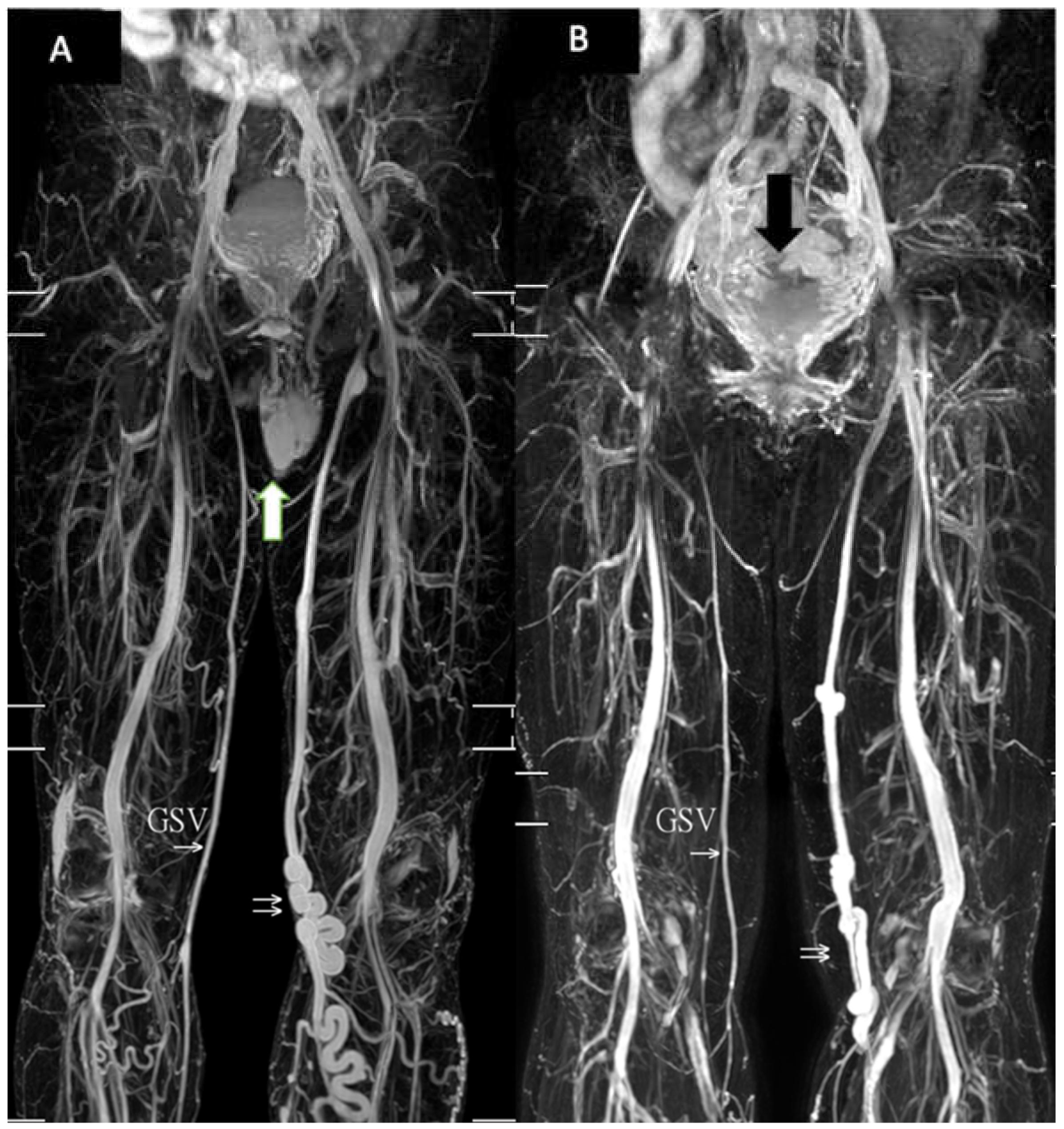 Jpm 11 00242 g004 Jpm 11 00242 g004