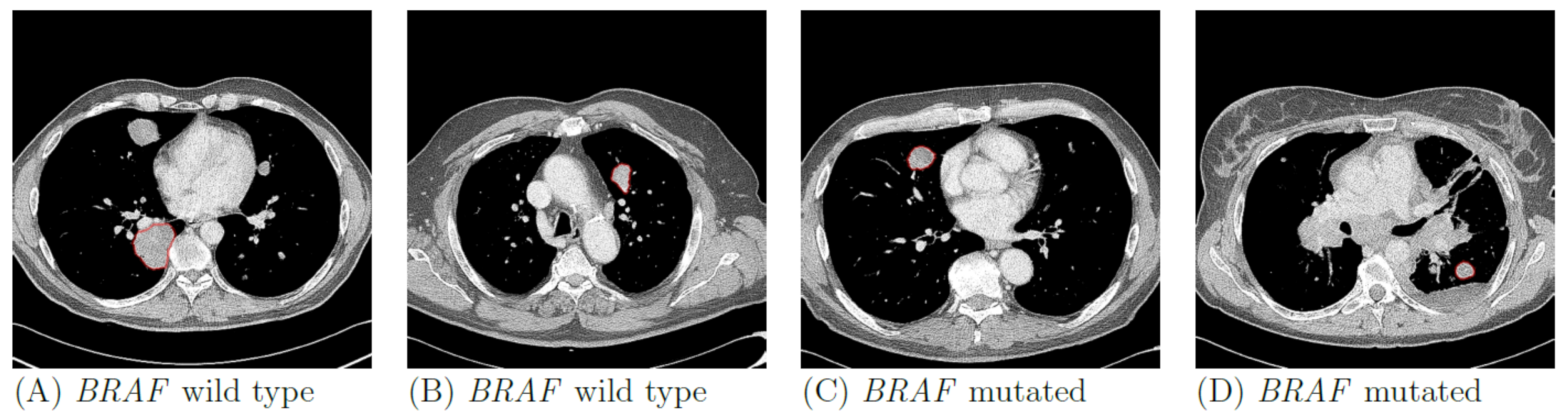 Jpm 11 00257 g002 Jpm 11 00257 g002