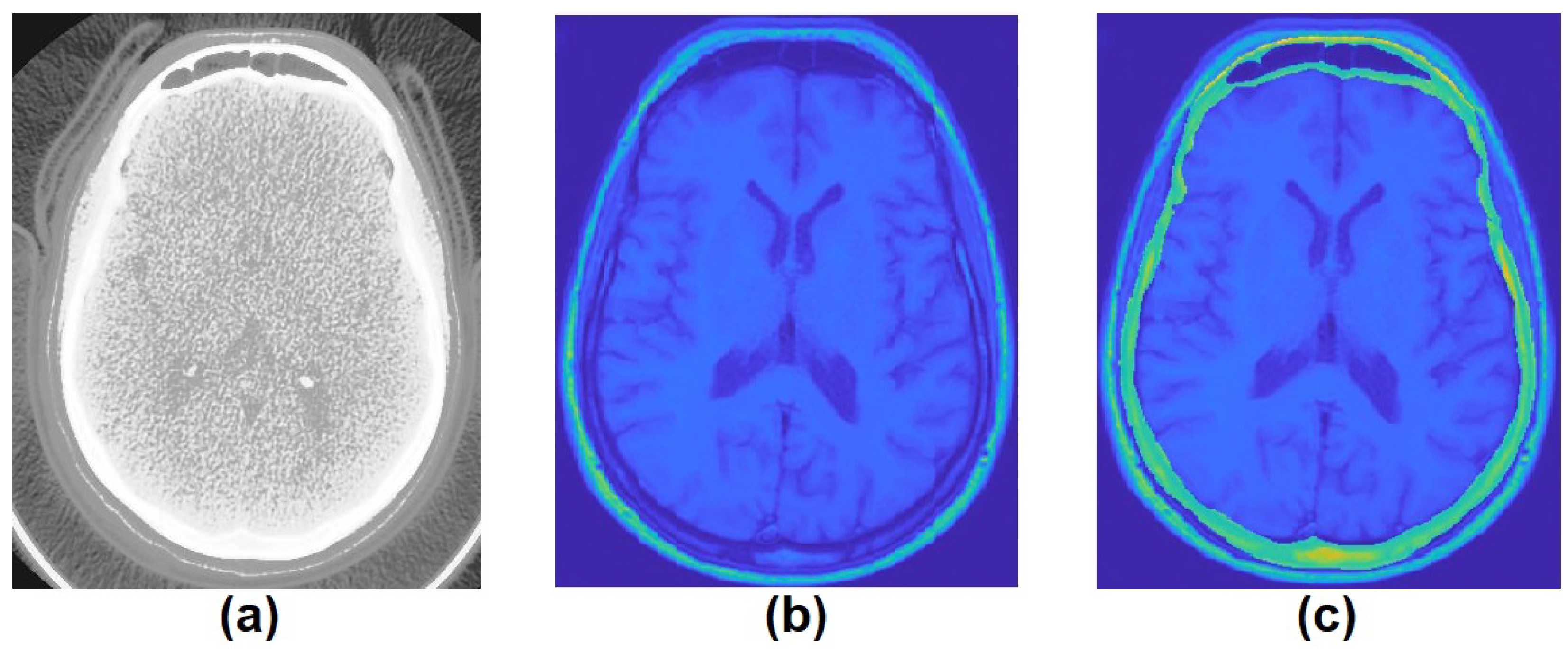 Jpm 11 00310 g003 Jpm 11 00310 g003