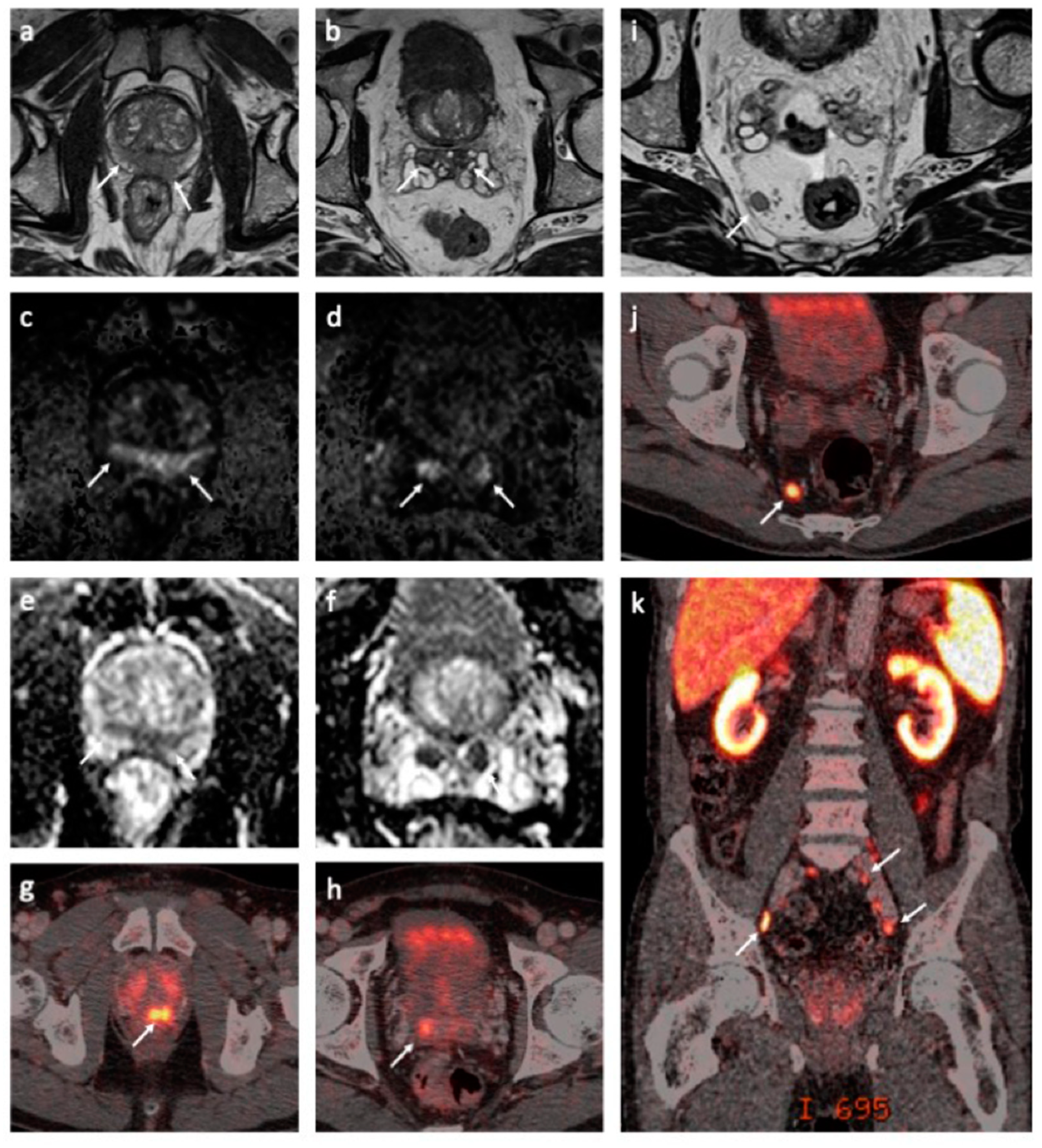 Jpm 11 00330 g001 Jpm 11 00330 g001