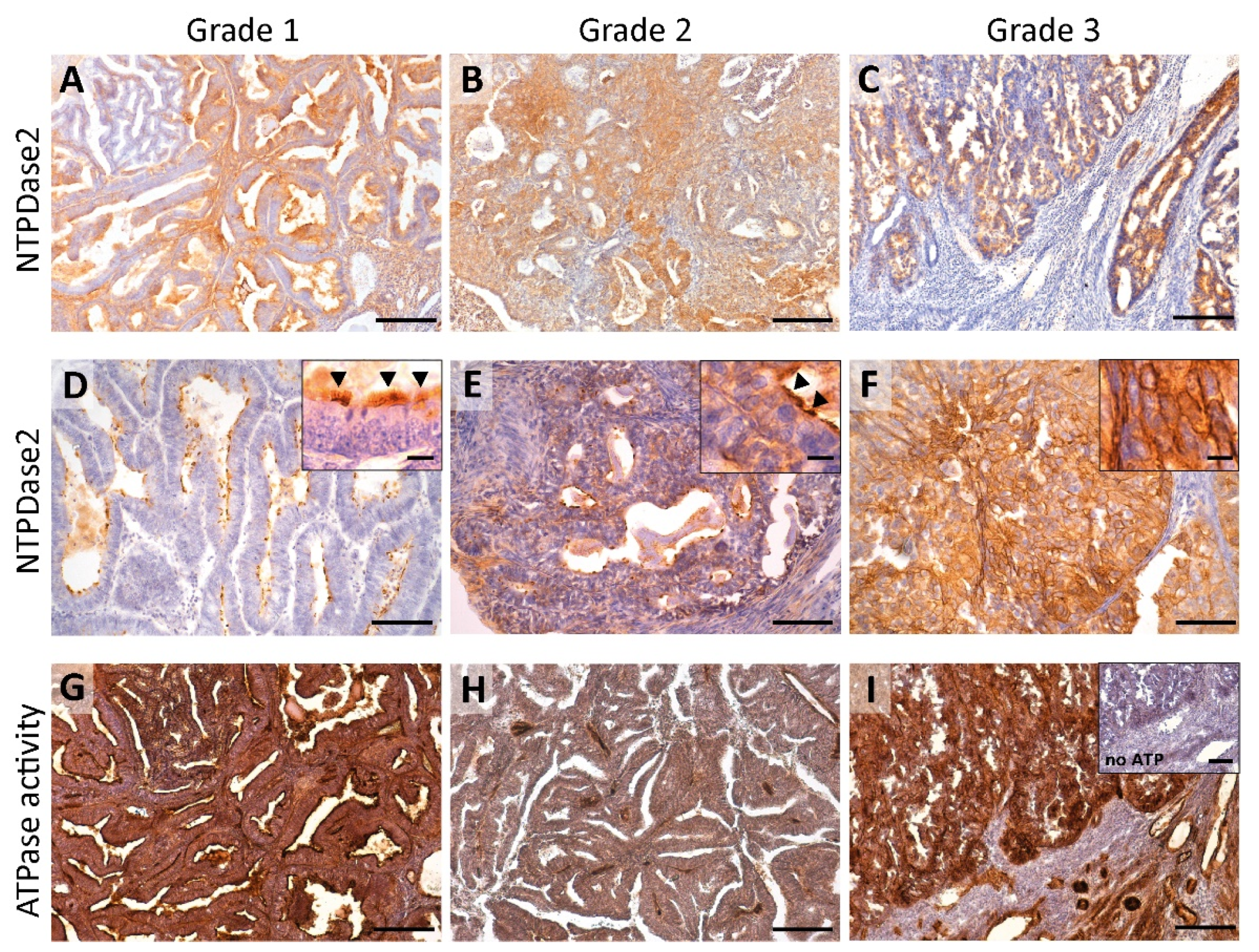 Jpm 11 00331 g001 Jpm 11 00331 g001