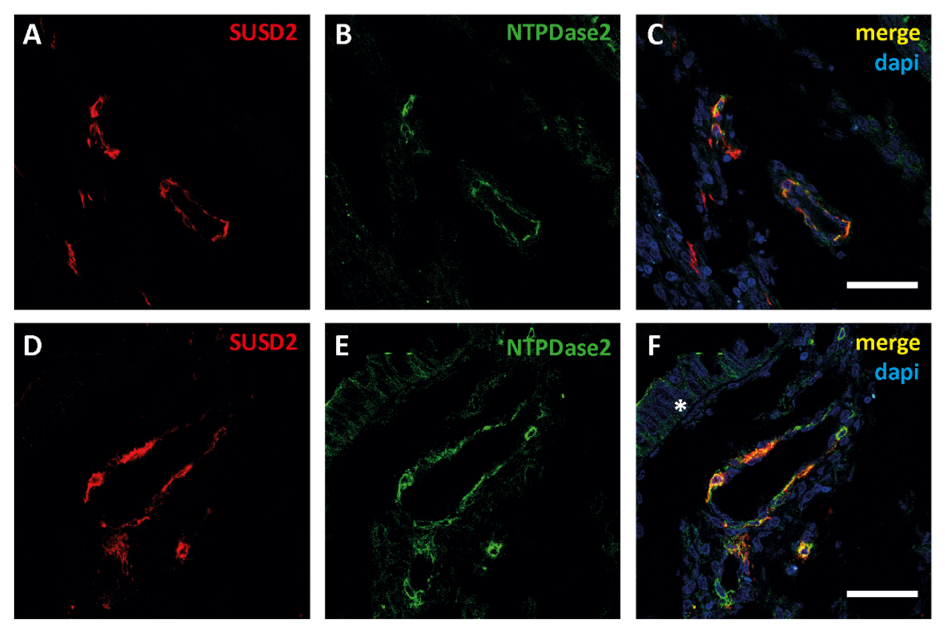 Jpm 11 00331 g005 Jpm 11 00331 g005