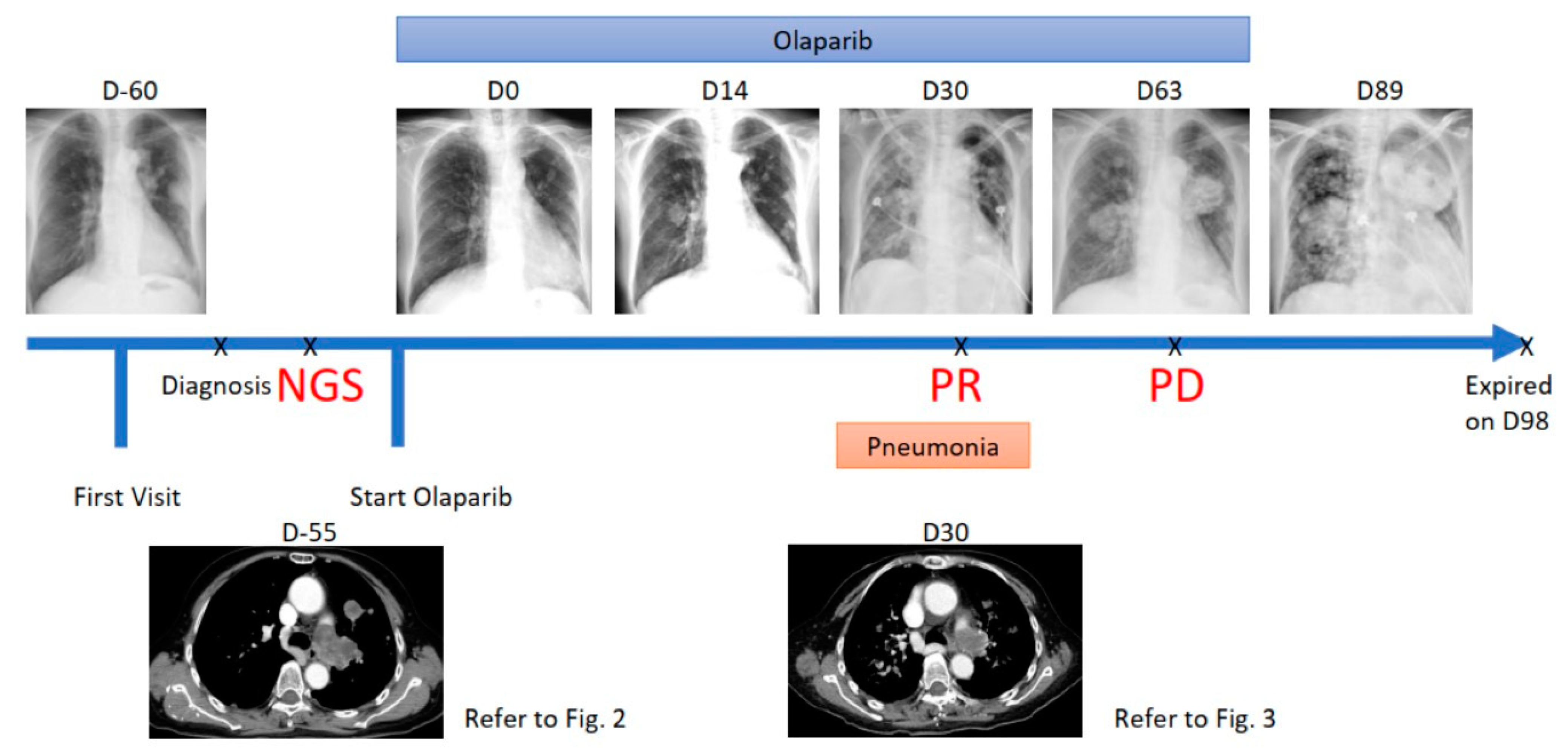 Jpm 11 00357 g001 Jpm 11 00357 g001